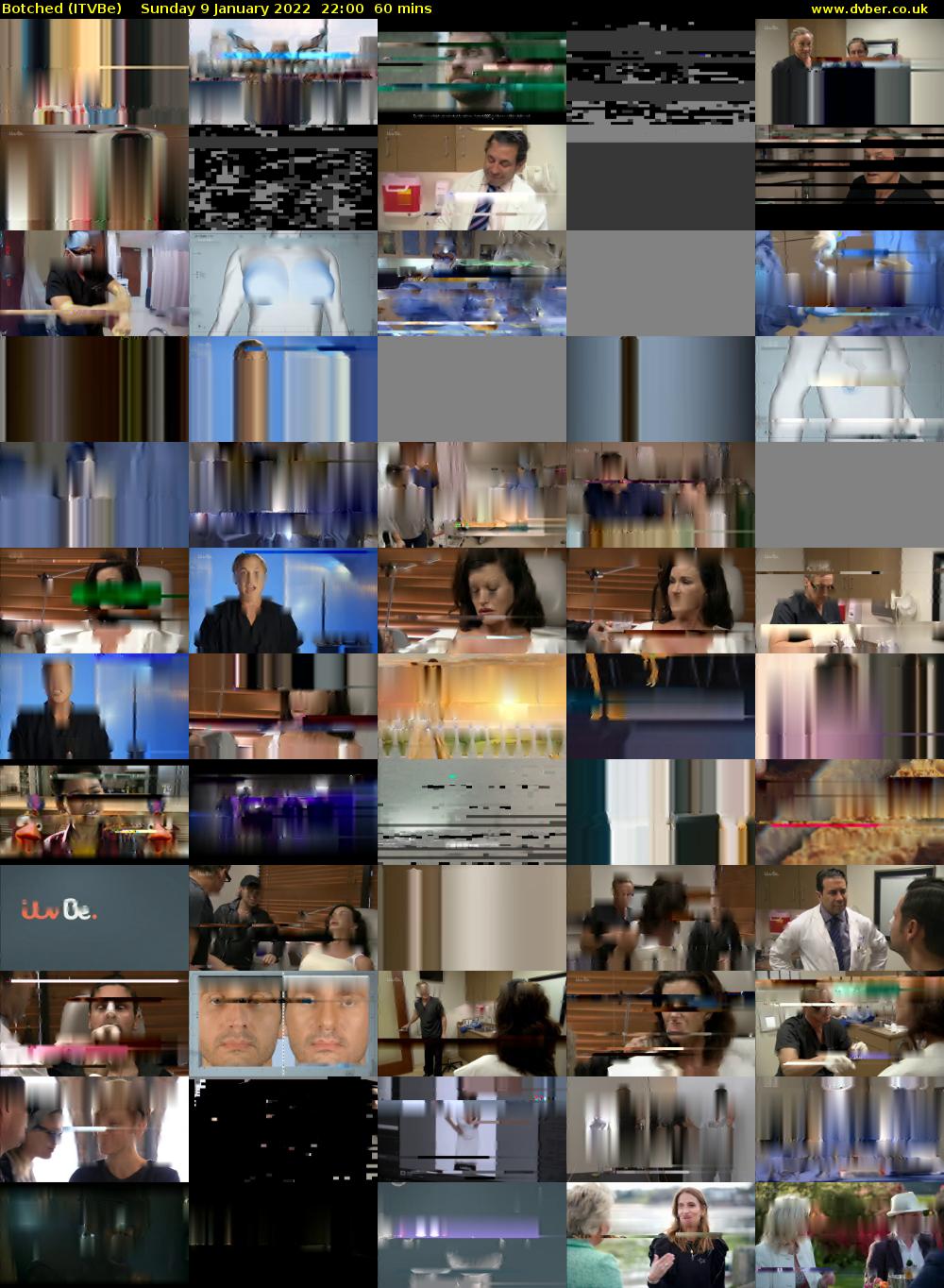 Botched (ITVBe) Sunday 9 January 2022 22:00 - 23:00