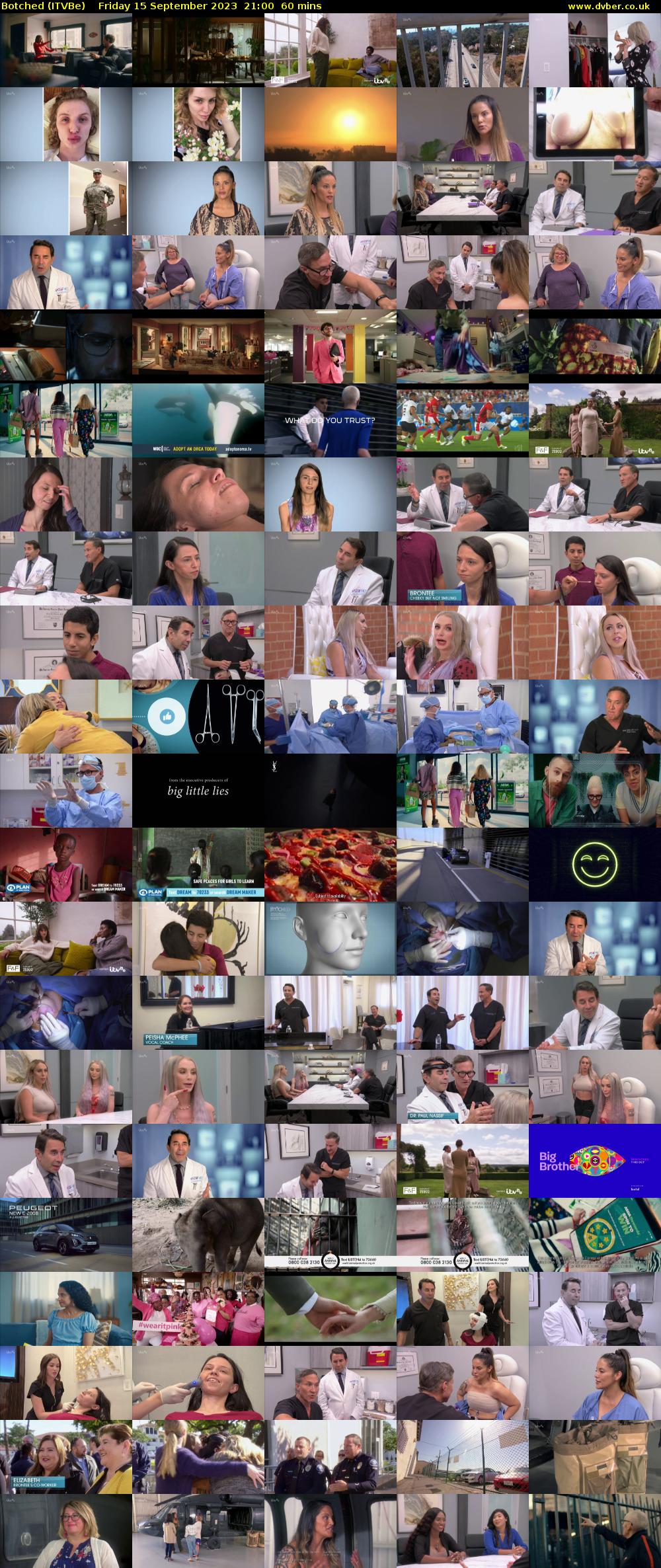 Botched (ITVBe) Friday 15 September 2023 21:00 - 22:00