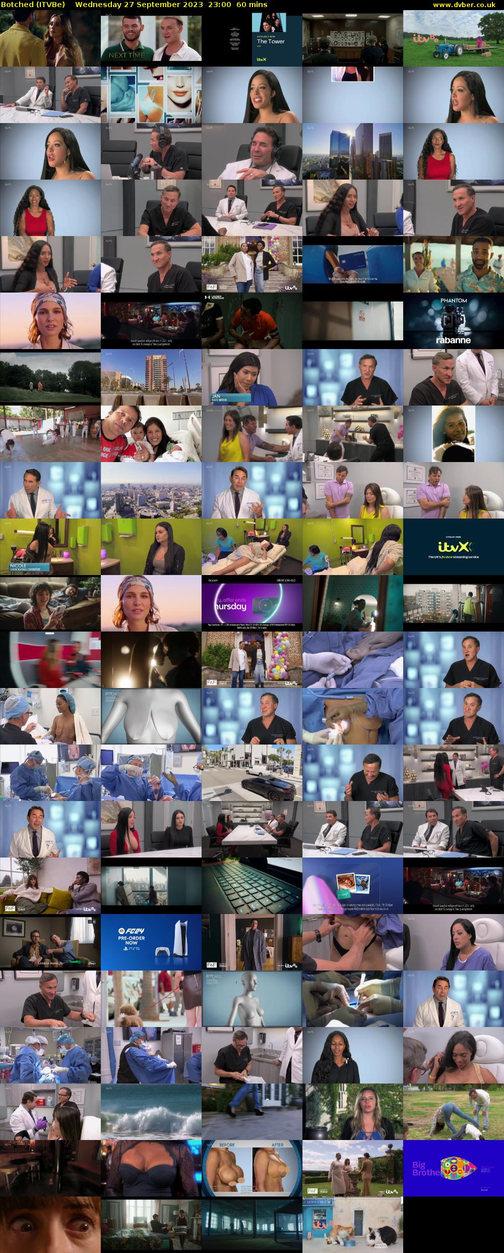 Botched (ITVBe) Wednesday 27 September 2023 23:00 - 00:00