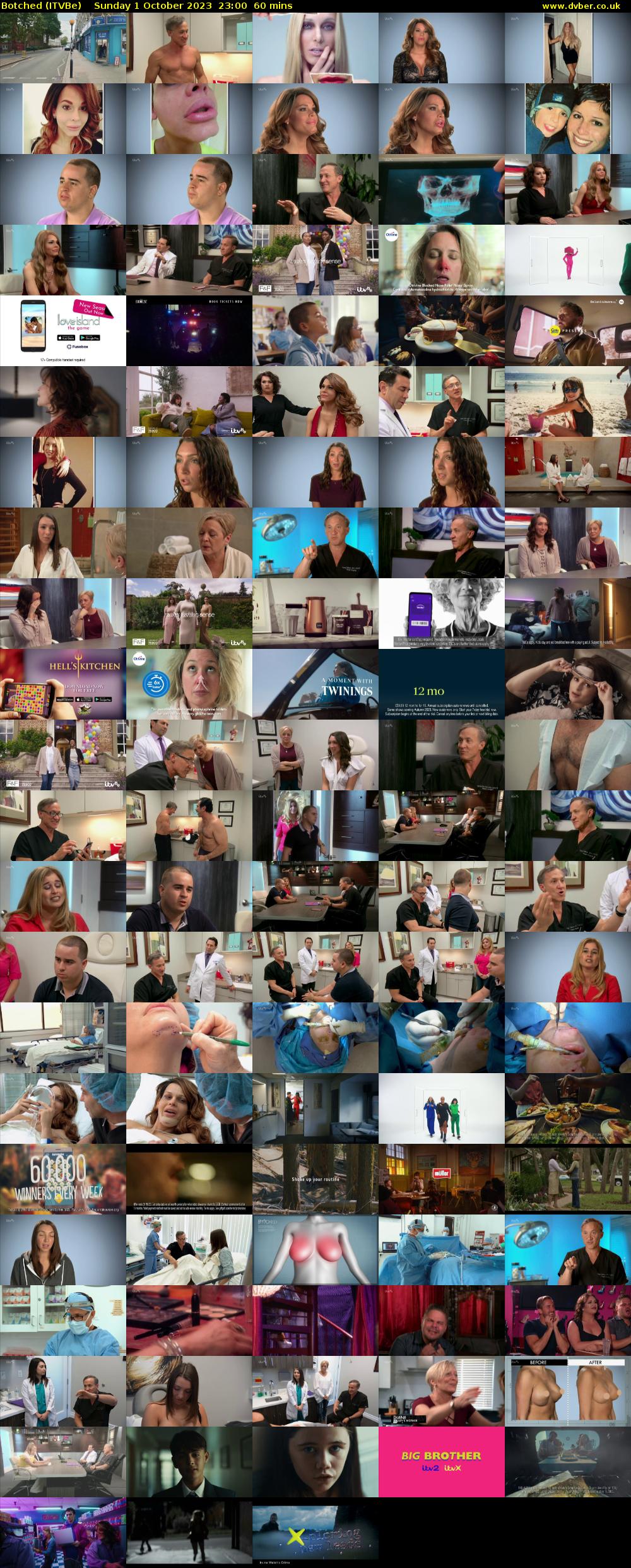 Botched (ITVBe) Sunday 1 October 2023 23:00 - 00:00