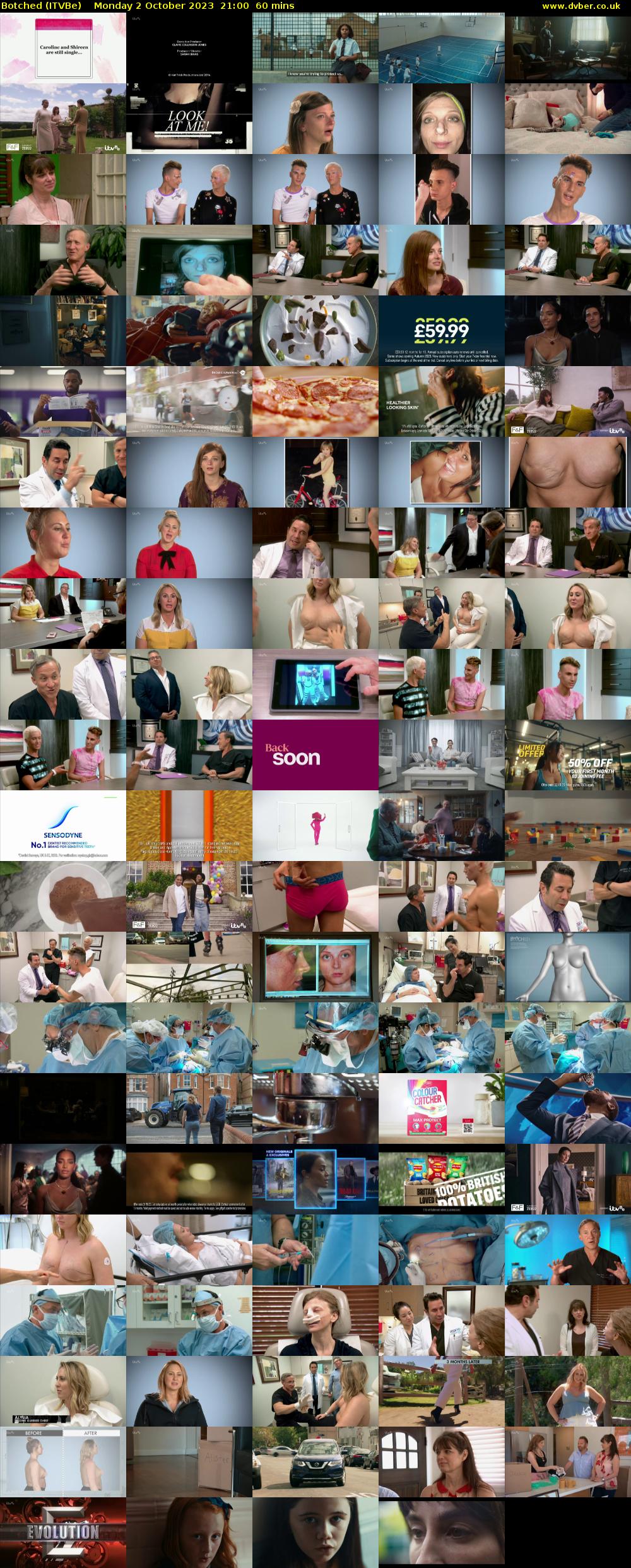 Botched (ITVBe) Monday 2 October 2023 21:00 - 22:00