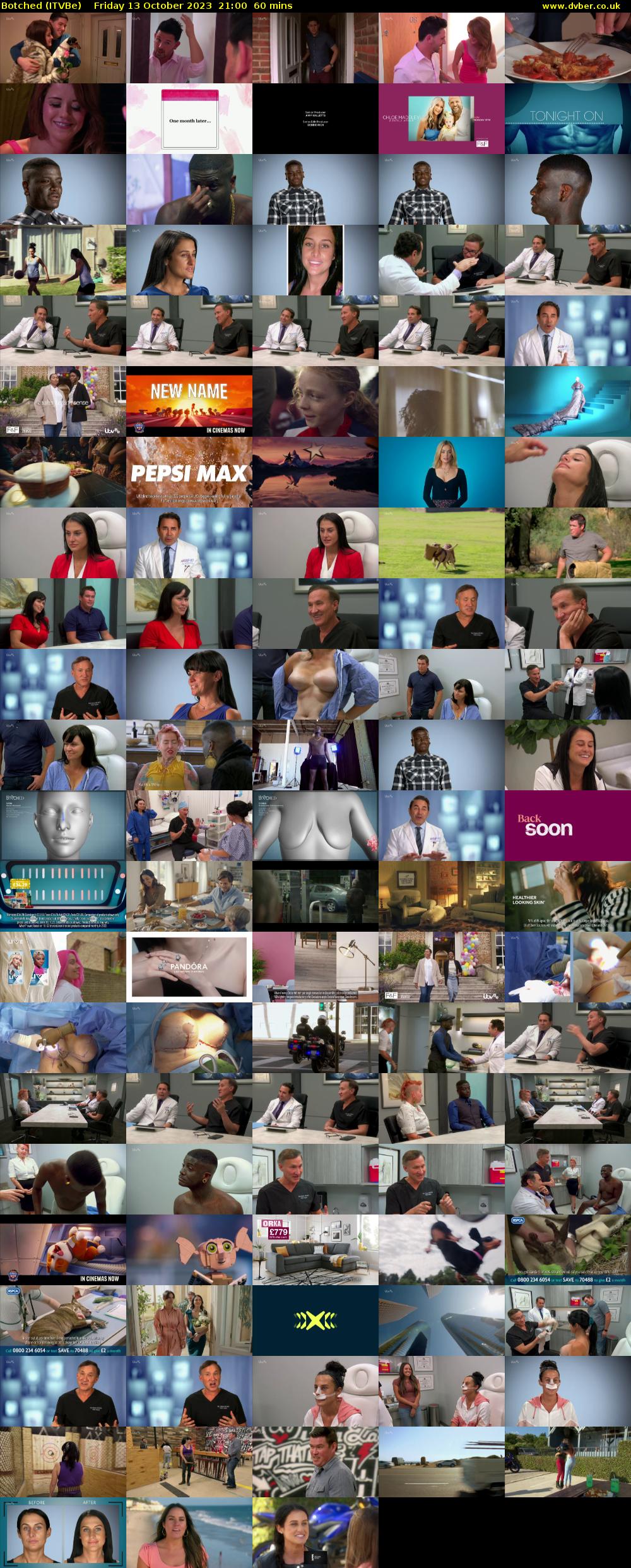 Botched (ITVBe) Friday 13 October 2023 21:00 - 22:00