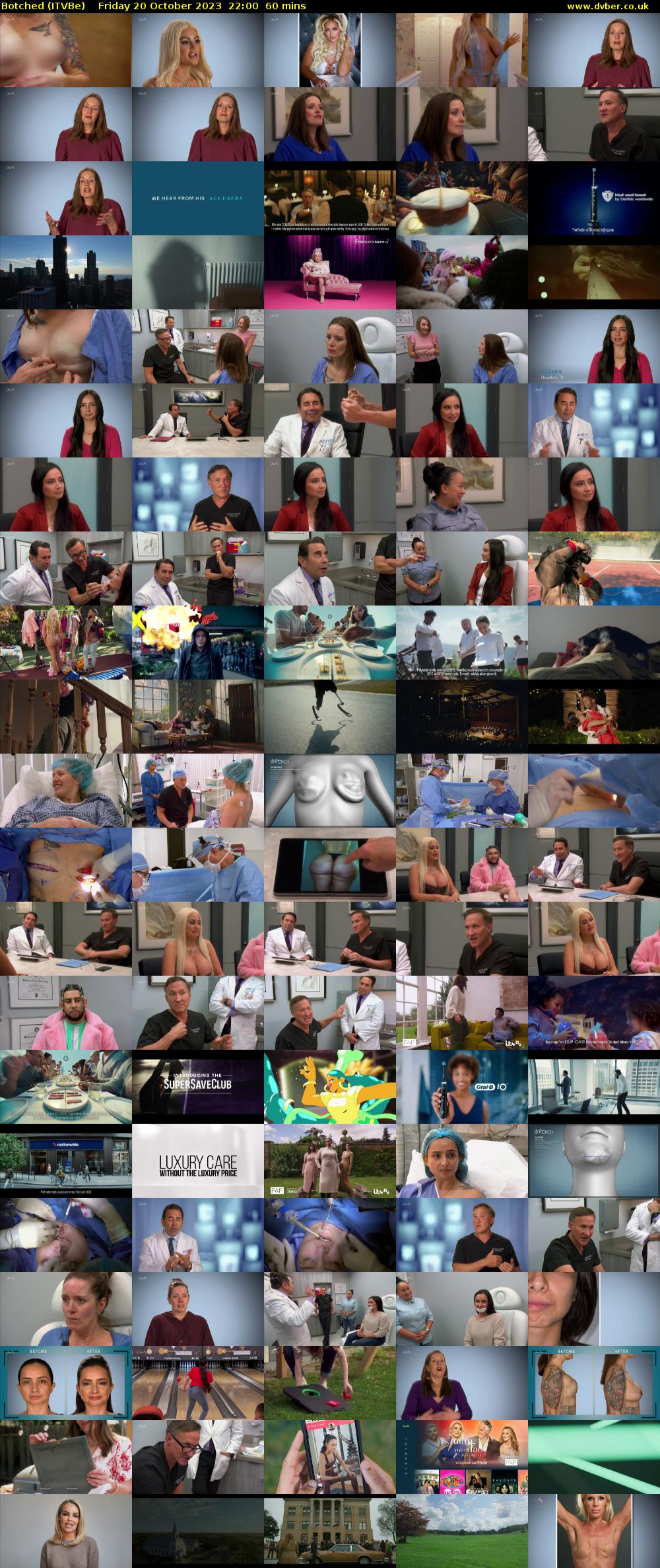 Botched (ITVBe) Friday 20 October 2023 22:00 - 23:00