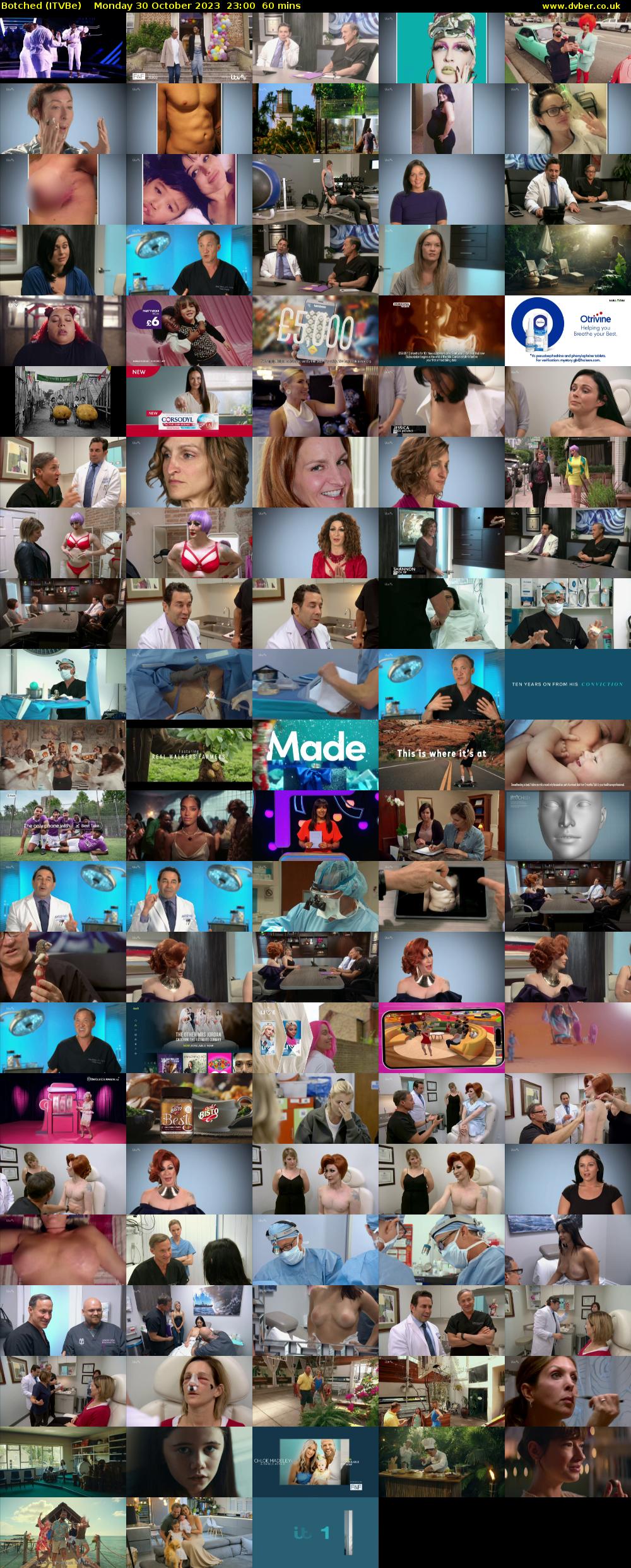 Botched (ITVBe) Monday 30 October 2023 23:00 - 00:00