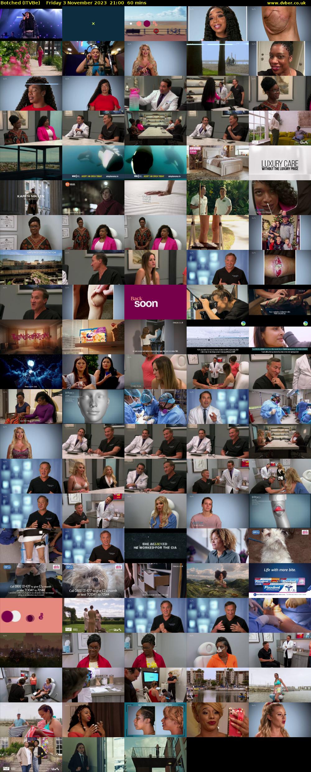Botched (ITVBe) Friday 3 November 2023 21:00 - 22:00