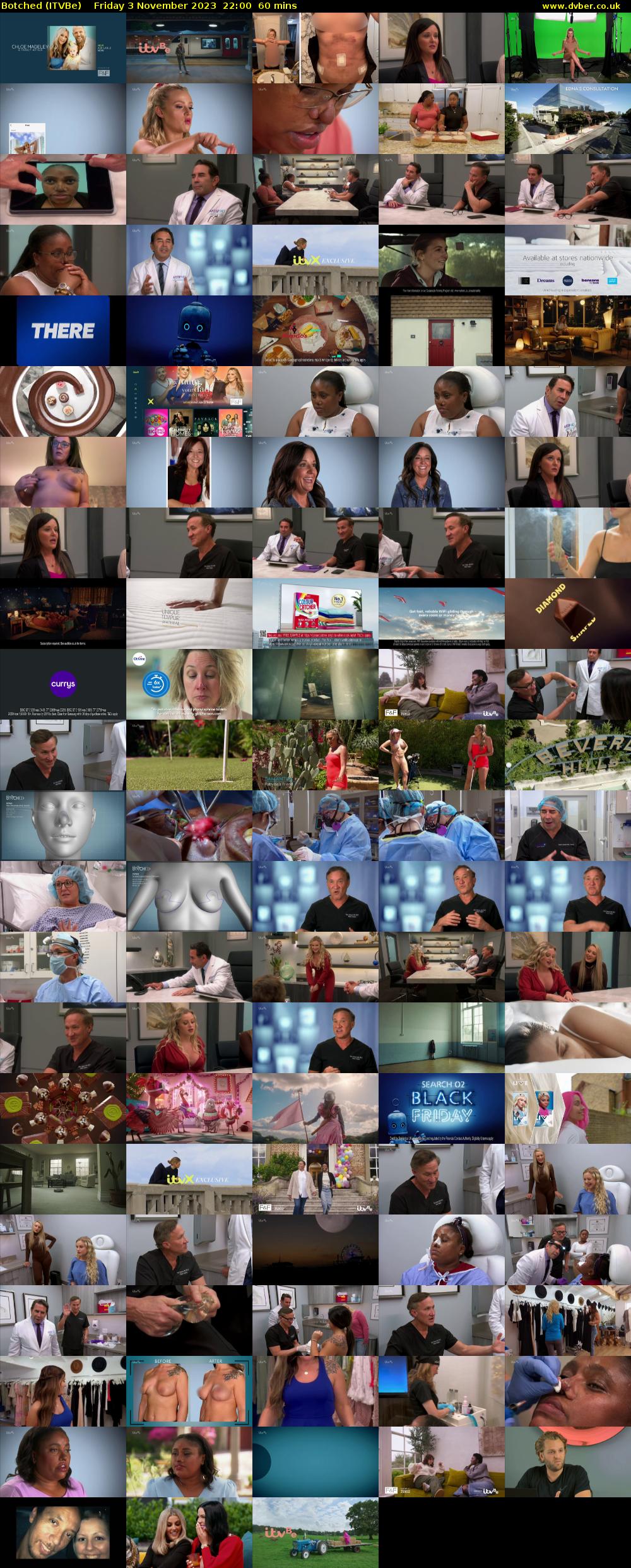 Botched (ITVBe) Friday 3 November 2023 22:00 - 23:00