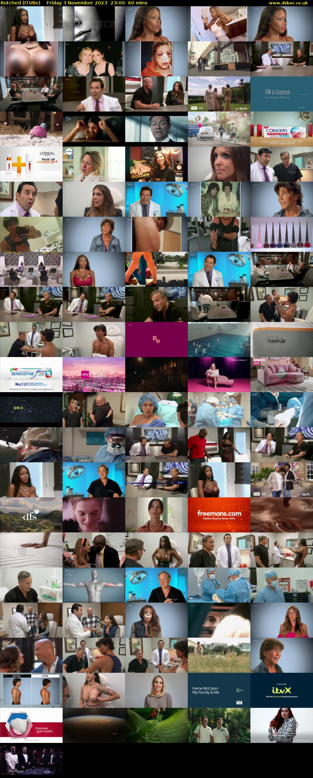 Botched (ITVBe) Friday 3 November 2023 23:00 - 00:00
