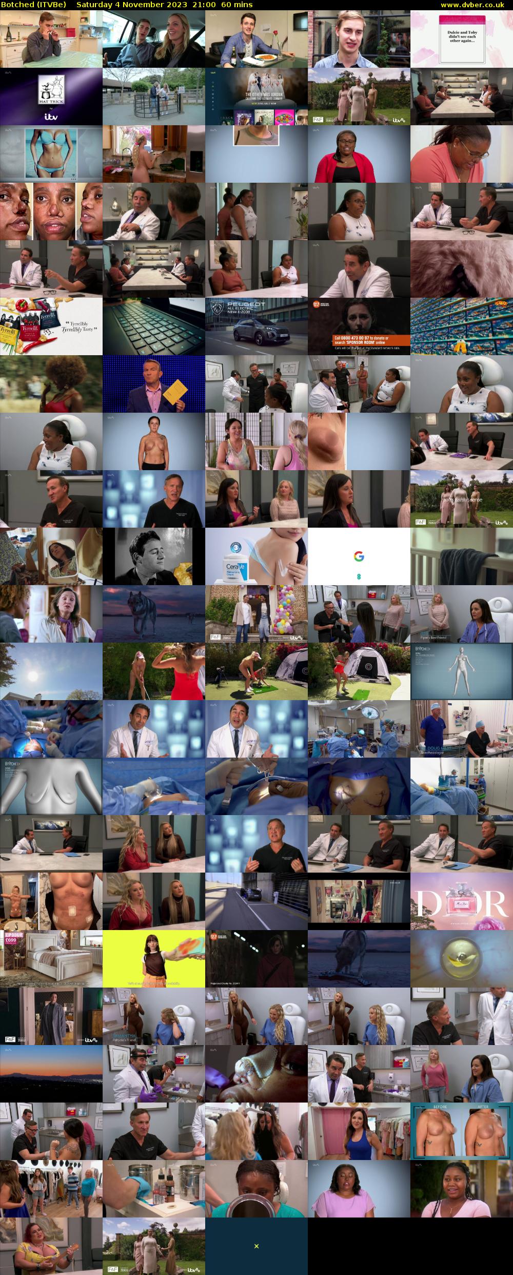 Botched (ITVBe) Saturday 4 November 2023 21:00 - 22:00