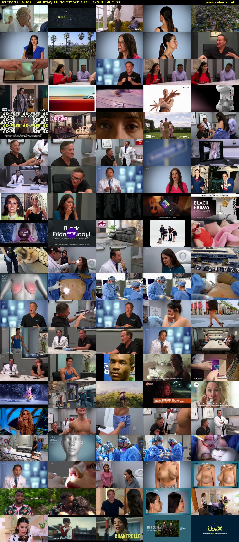 Botched (ITVBe) Saturday 18 November 2023 22:00 - 23:00