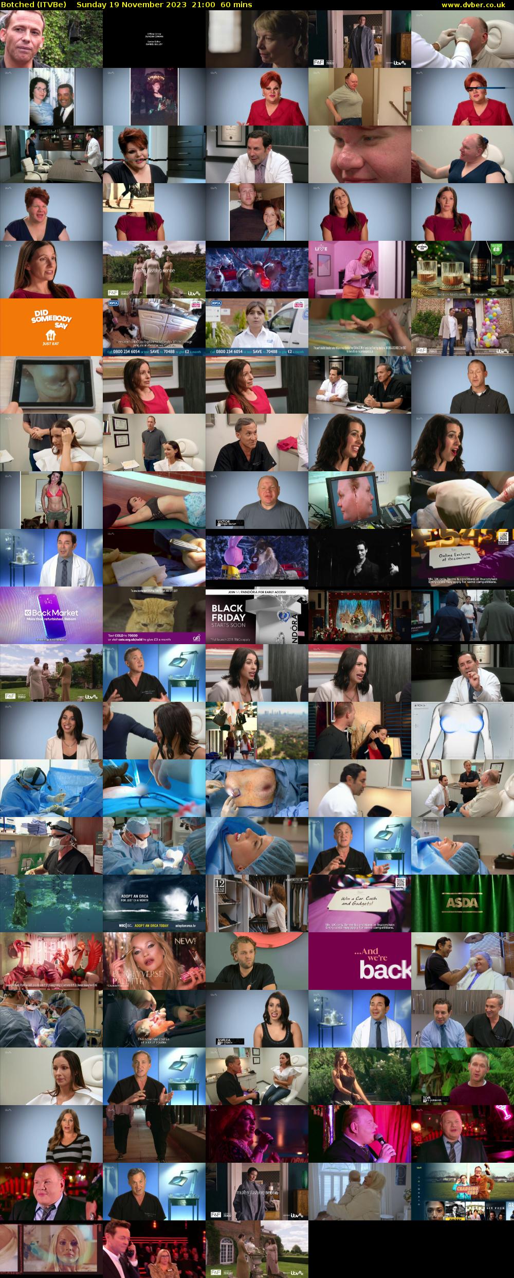 Botched (ITVBe) Sunday 19 November 2023 21:00 - 22:00