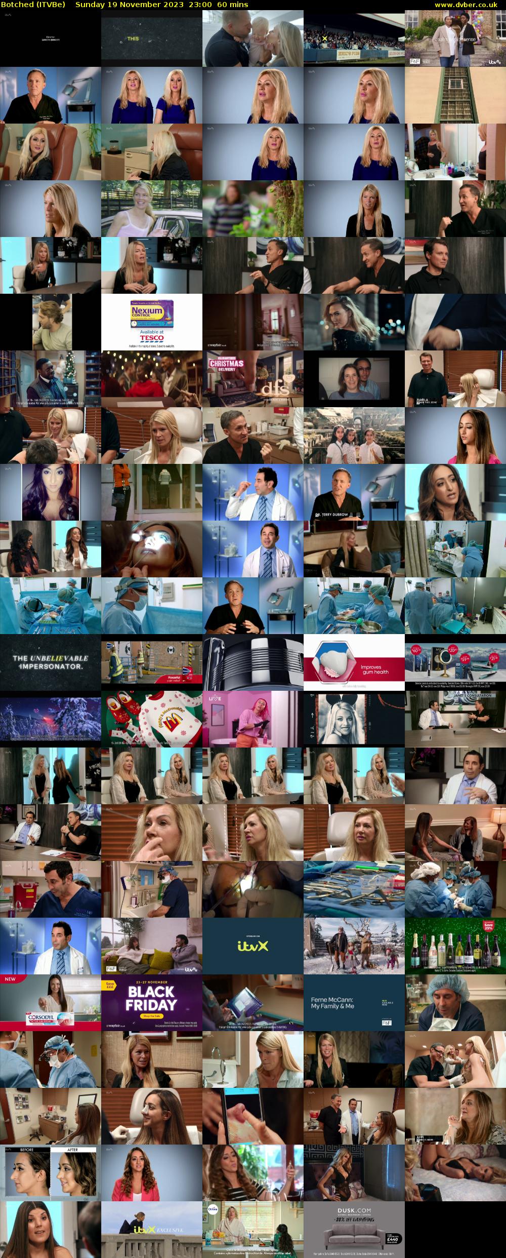 Botched (ITVBe) Sunday 19 November 2023 23:00 - 00:00
