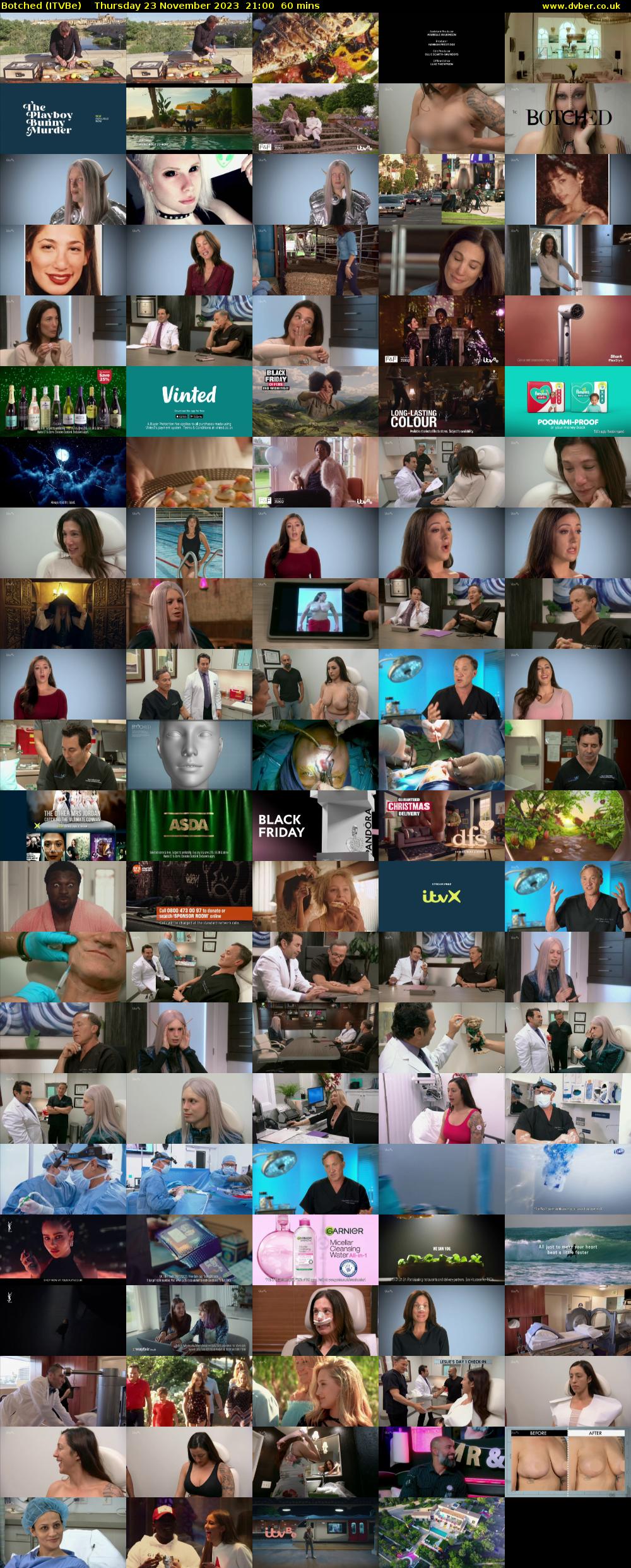 Botched (ITVBe) Thursday 23 November 2023 21:00 - 22:00
