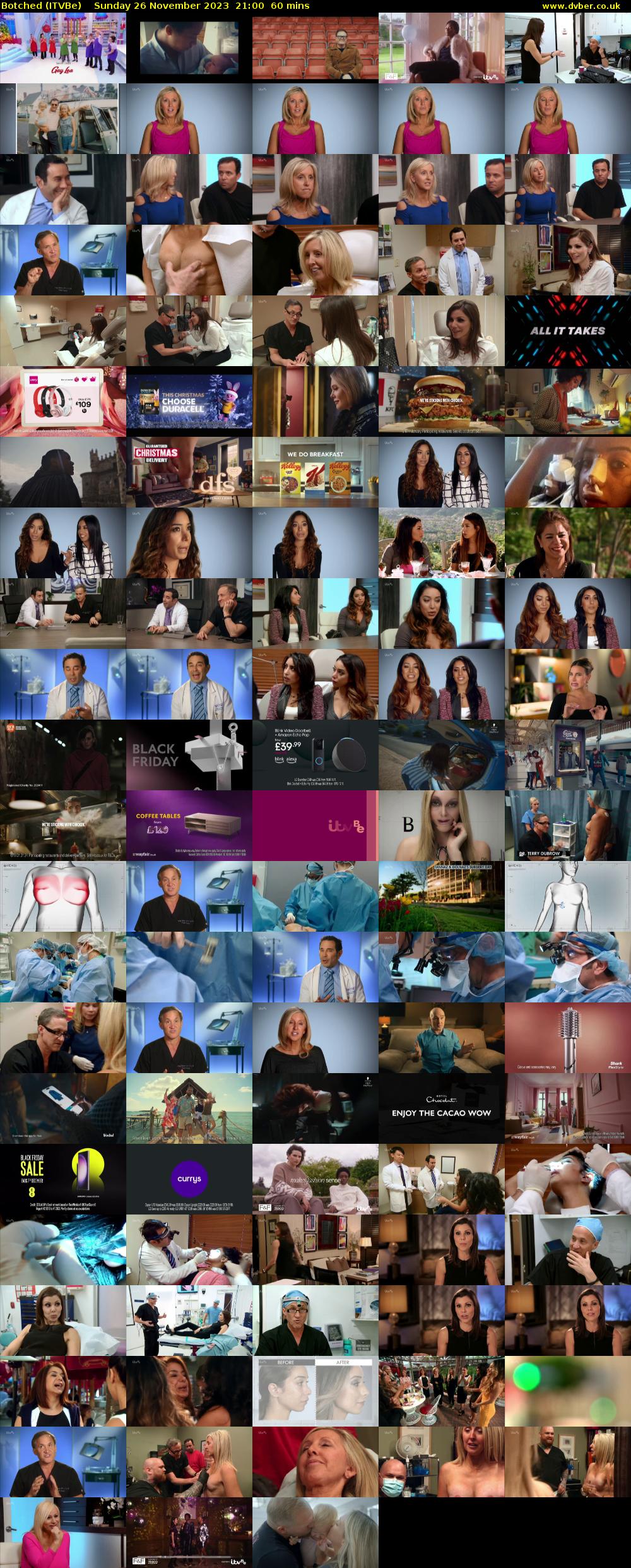 Botched (ITVBe) Sunday 26 November 2023 21:00 - 22:00