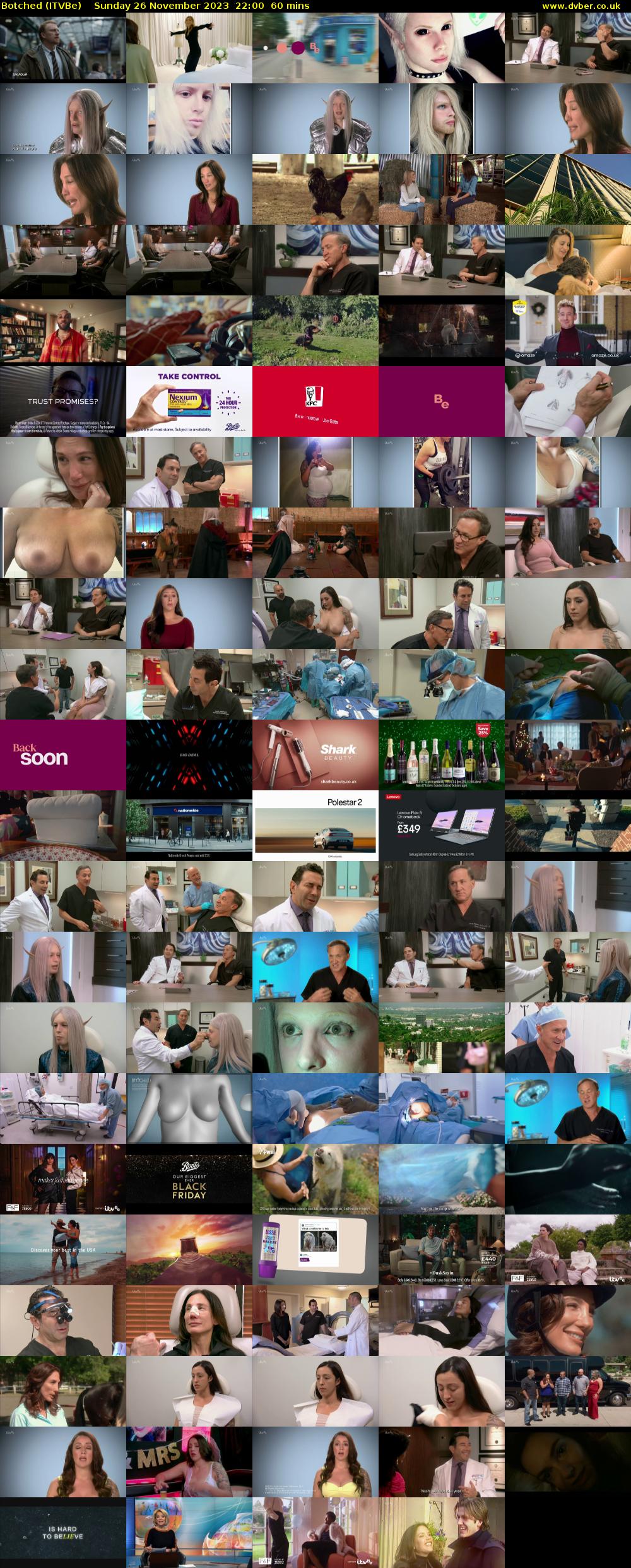 Botched (ITVBe) Sunday 26 November 2023 22:00 - 23:00