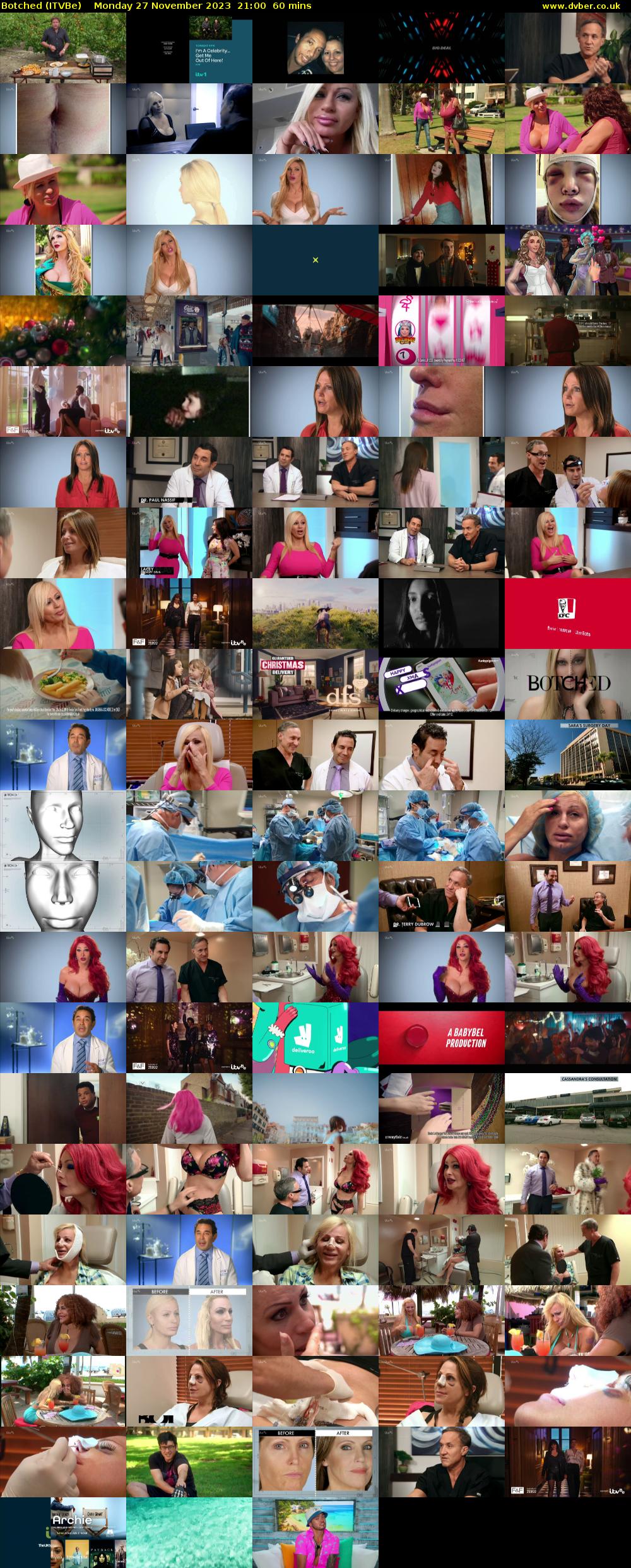 Botched (ITVBe) Monday 27 November 2023 21:00 - 22:00
