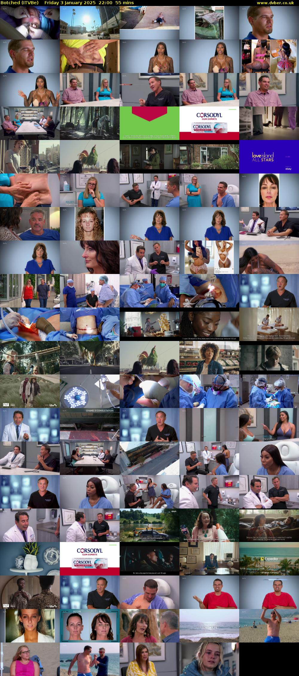 Botched (ITVBe) Friday 3 January 2025 22:00 - 22:55