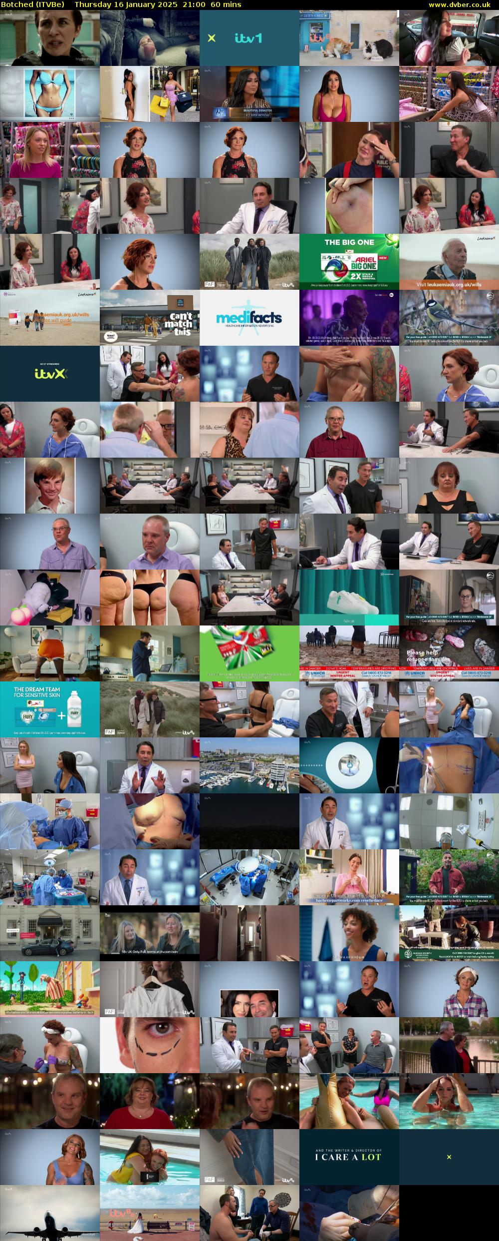 Botched (ITVBe) Thursday 16 January 2025 21:00 - 22:00