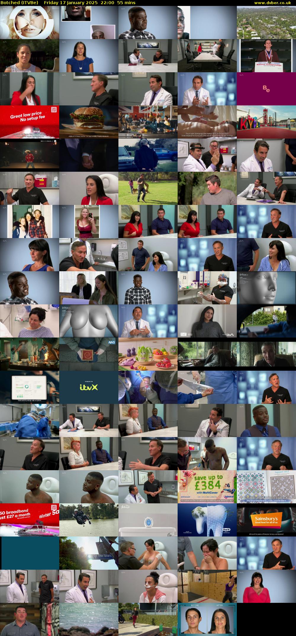 Botched (ITVBe) Friday 17 January 2025 22:00 - 22:55