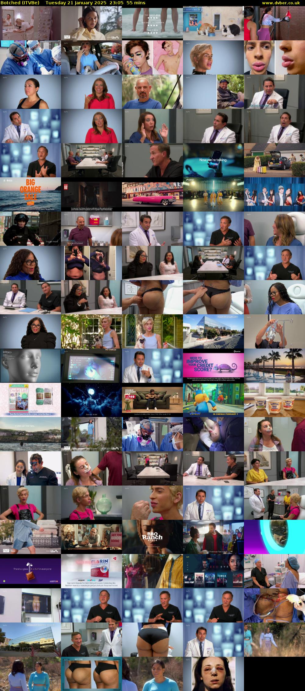 Botched (ITVBe) Tuesday 21 January 2025 23:05 - 00:00