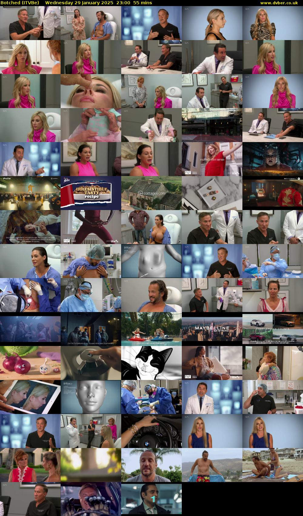 Botched (ITVBe) Wednesday 29 January 2025 23:00 - 23:55