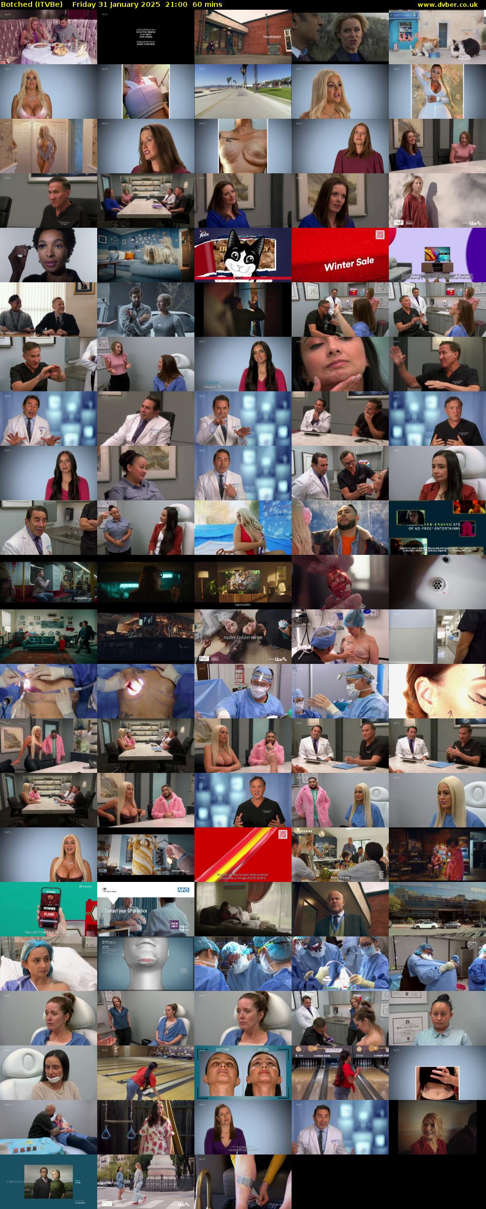 Botched (ITVBe) Friday 31 January 2025 21:00 - 22:00