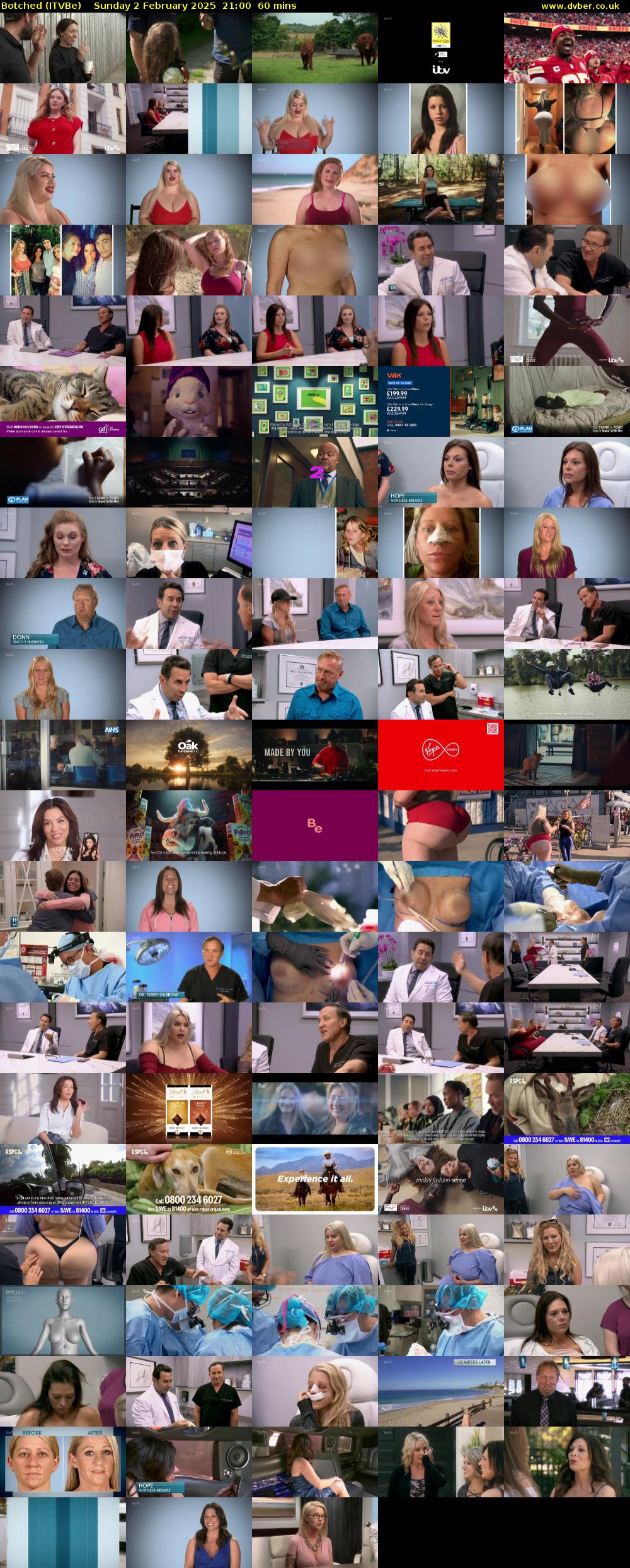 Botched (ITVBe) Sunday 2 February 2025 21:00 - 22:00