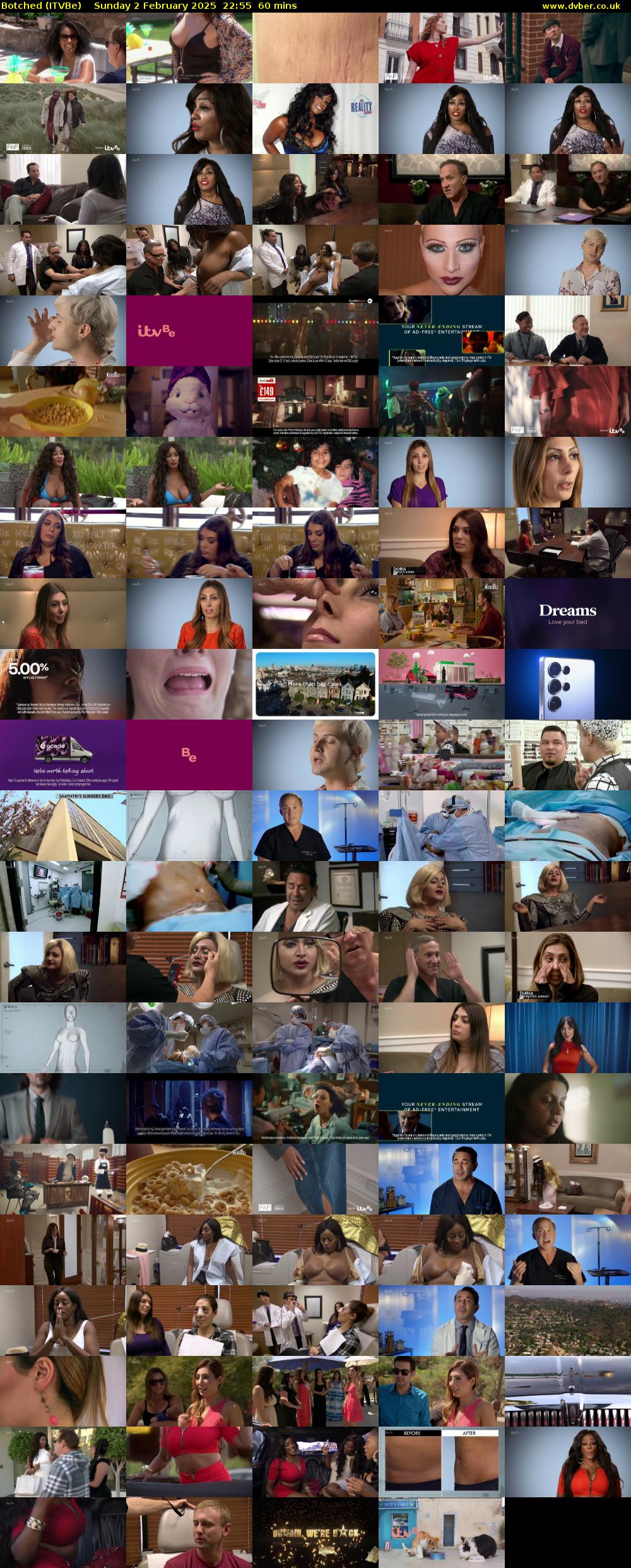 Botched (ITVBe) Sunday 2 February 2025 22:55 - 23:55