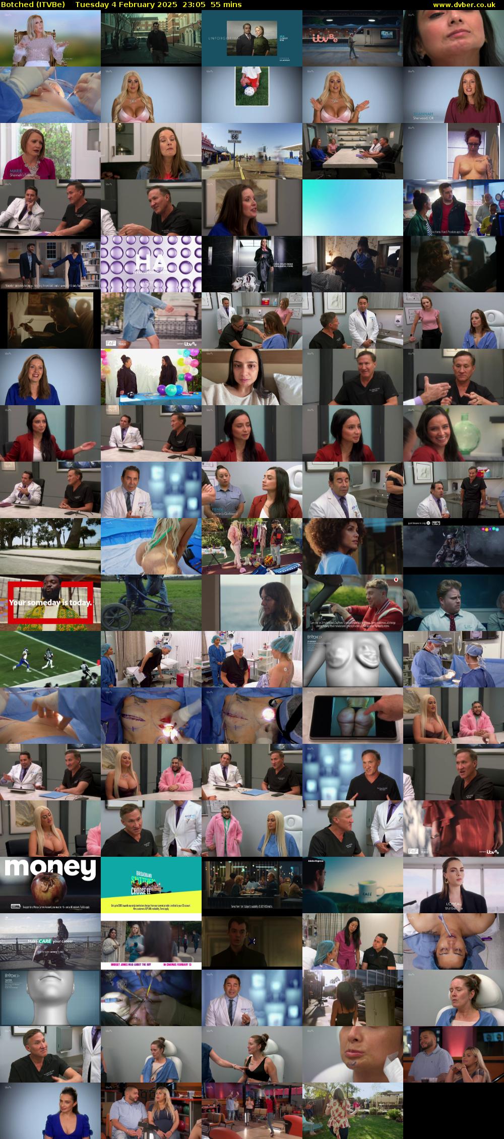 Botched (ITVBe) Tuesday 4 February 2025 23:05 - 00:00