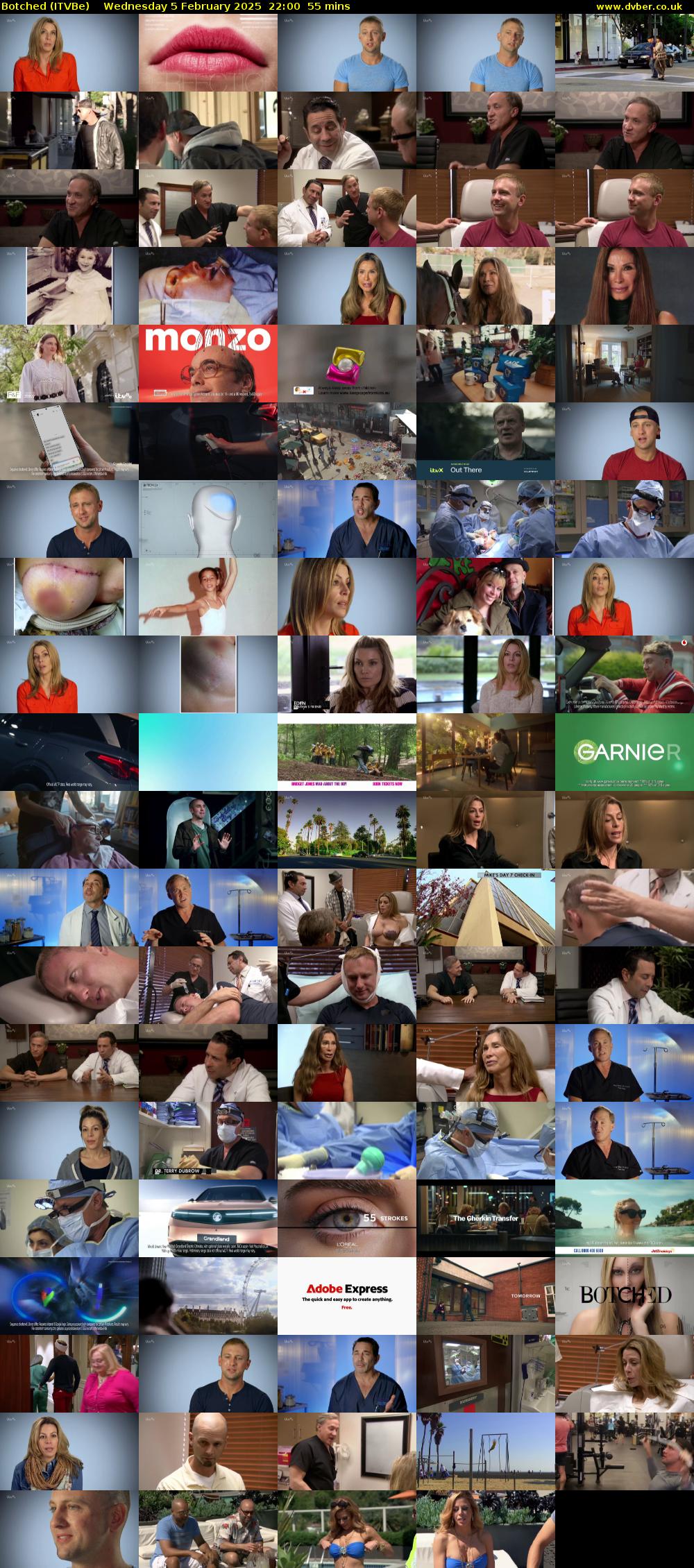 Botched (ITVBe) Wednesday 5 February 2025 22:00 - 22:55