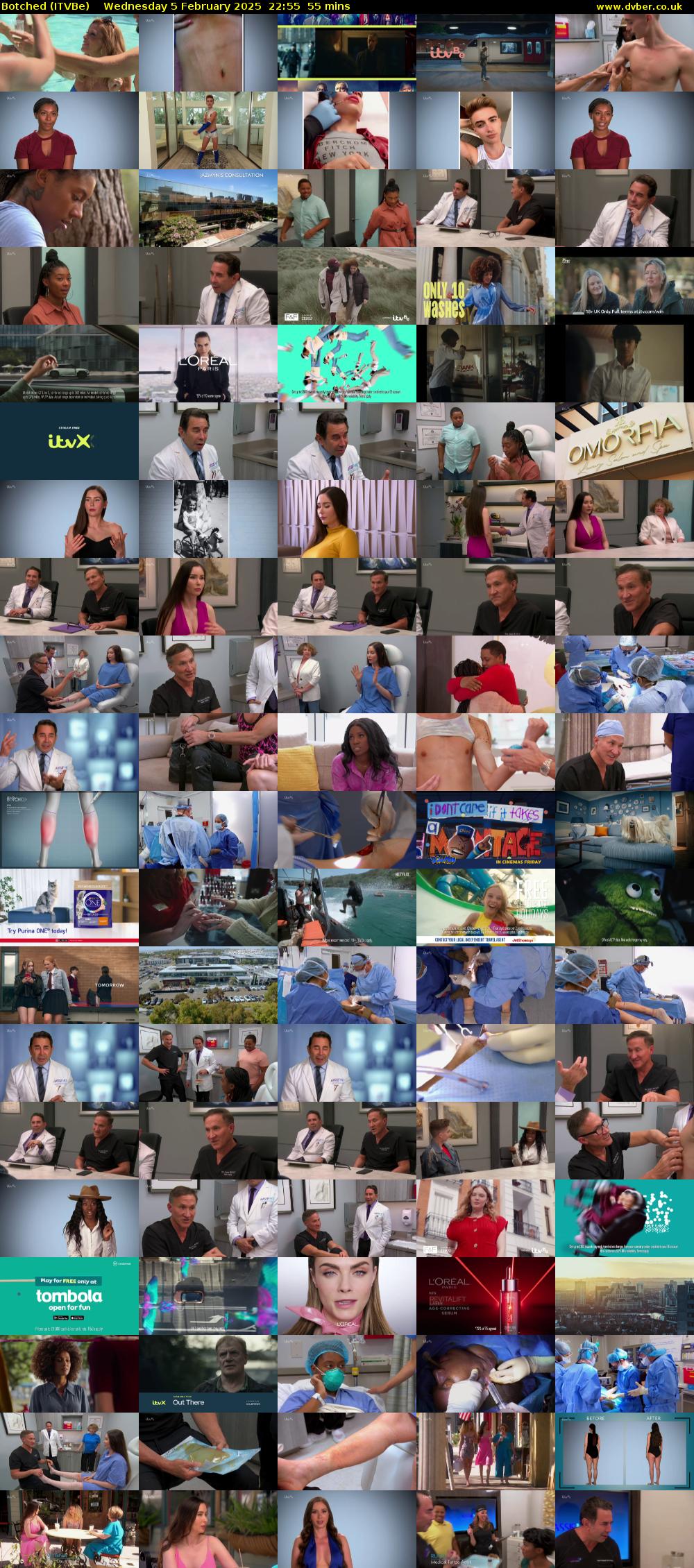 Botched (ITVBe) Wednesday 5 February 2025 22:55 - 23:50