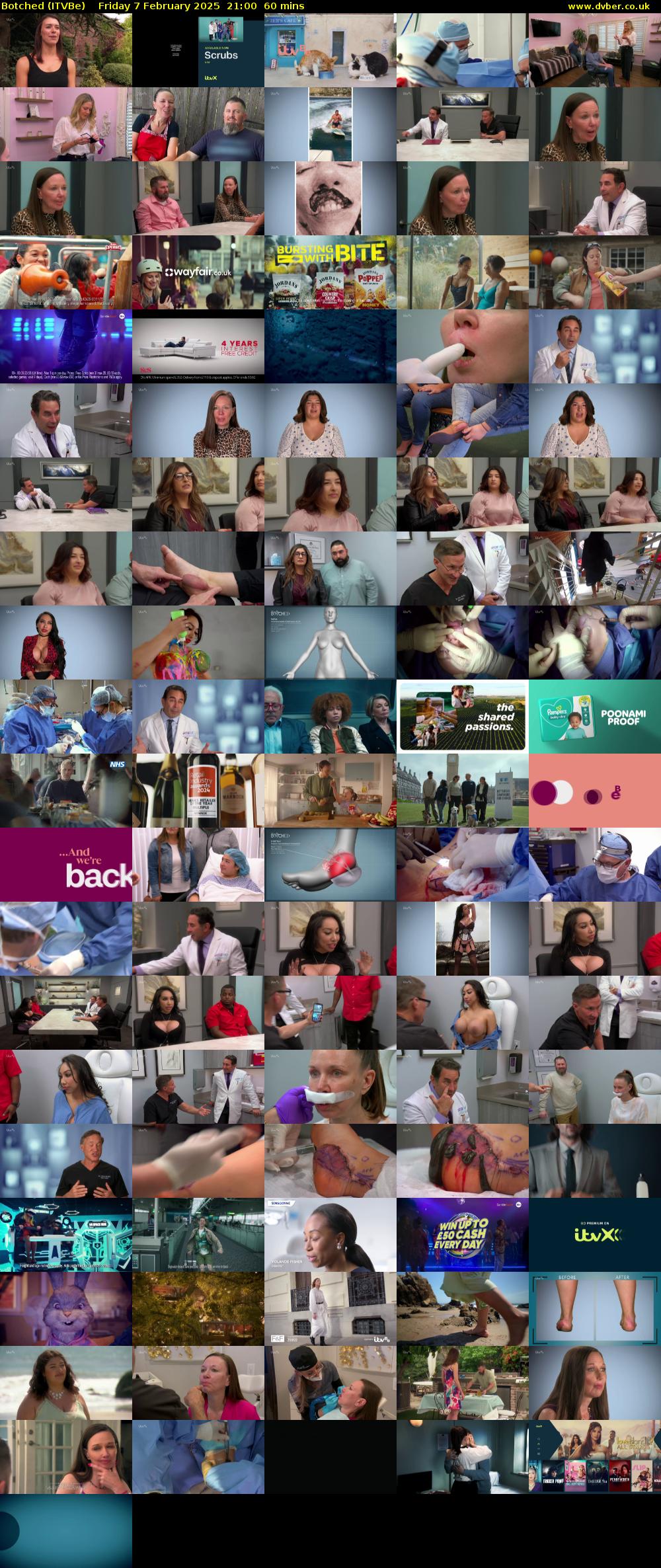 Botched (ITVBe) Friday 7 February 2025 21:00 - 22:00