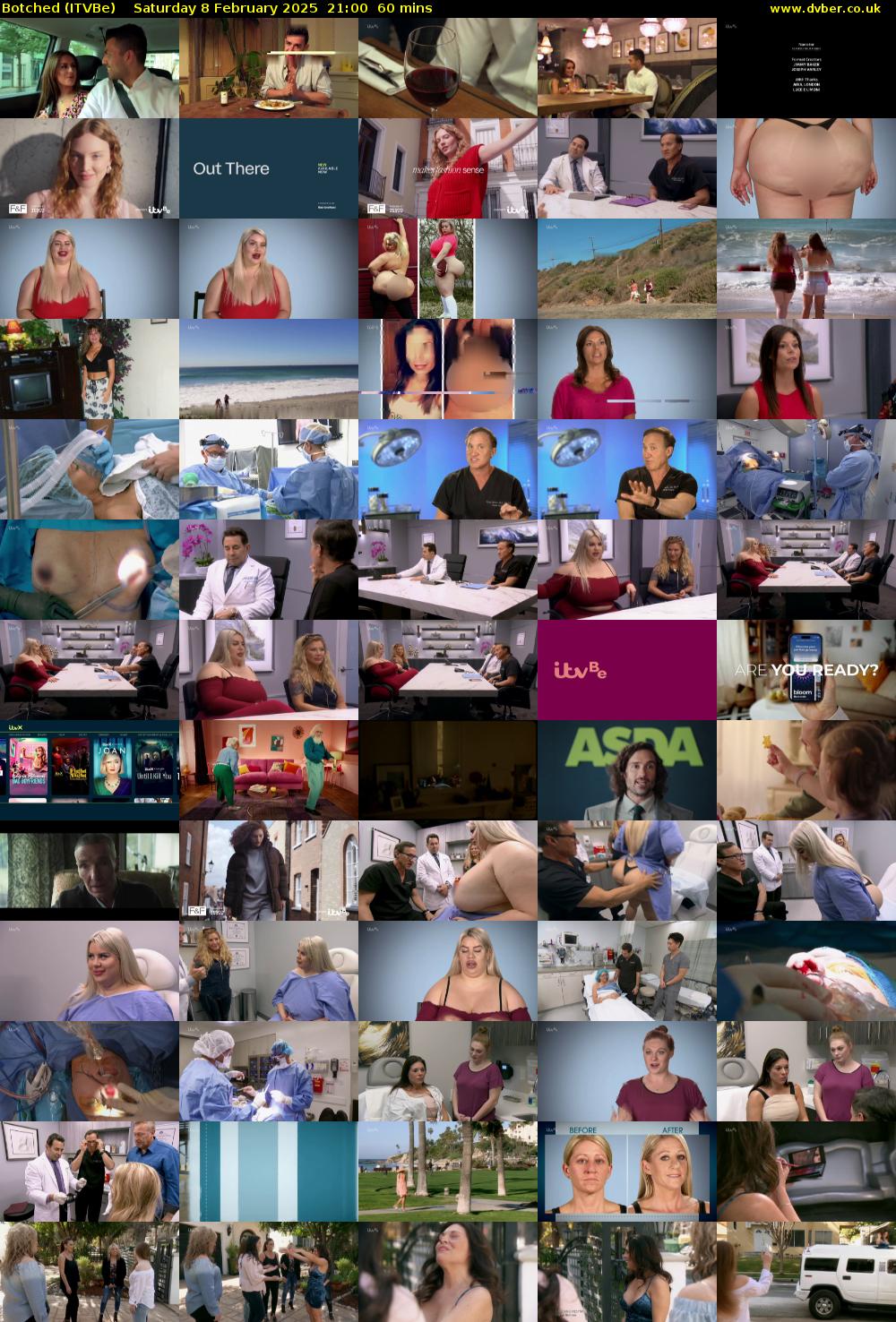Botched (ITVBe) Saturday 8 February 2025 21:00 - 22:00