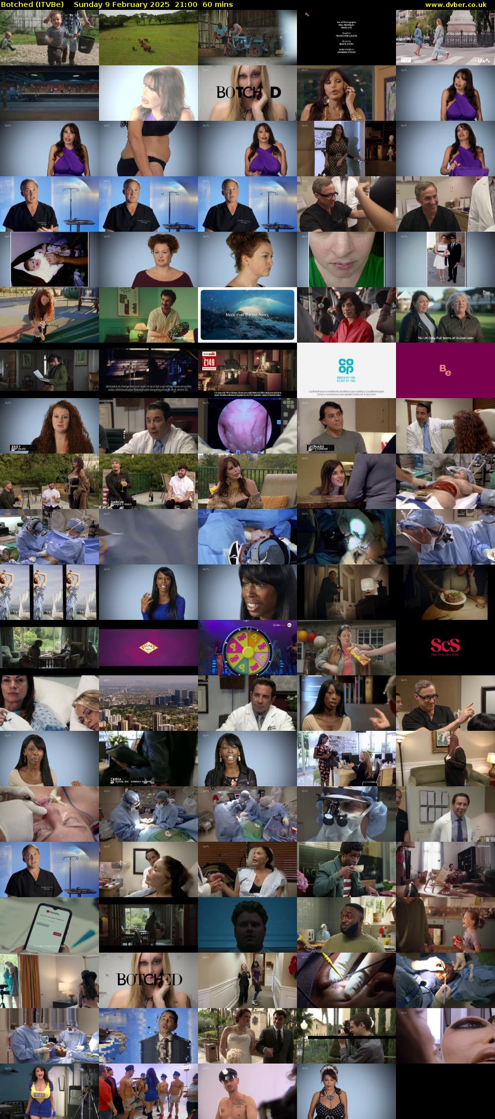 Botched (ITVBe) Sunday 9 February 2025 21:00 - 22:00