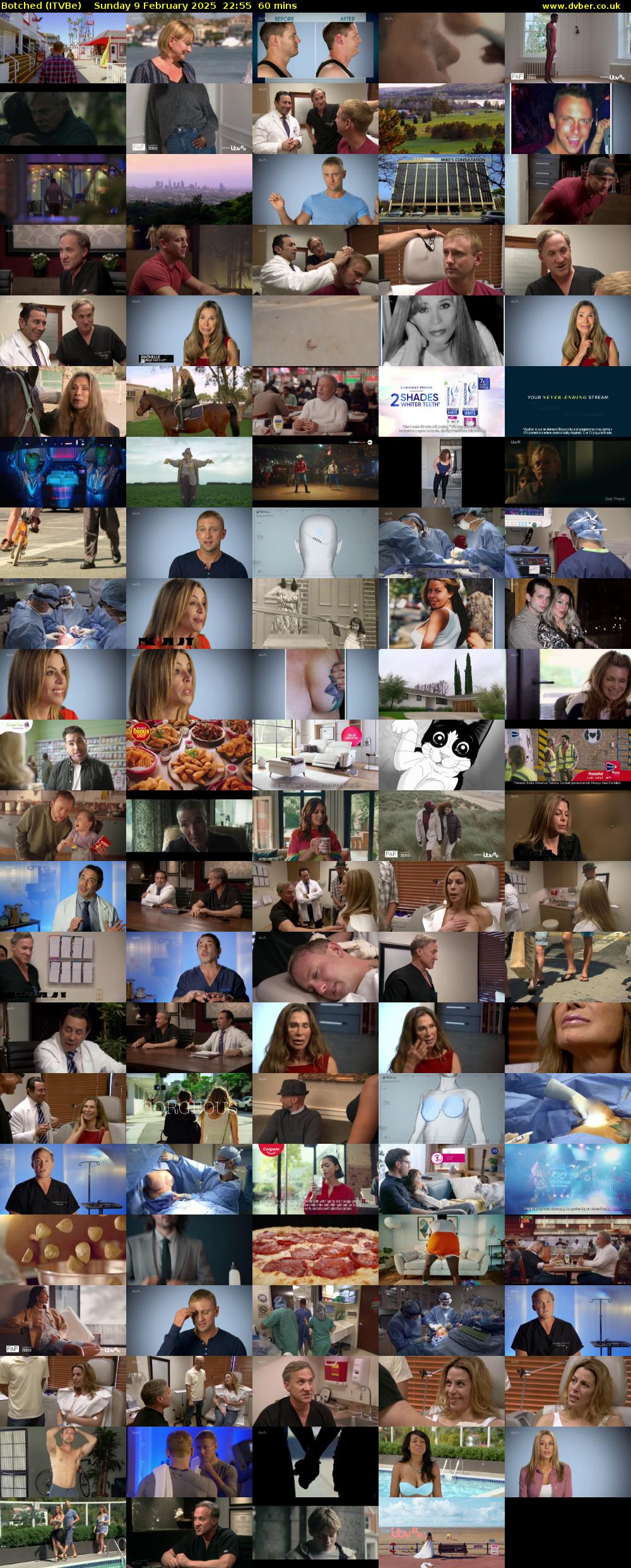 Botched (ITVBe) Sunday 9 February 2025 22:55 - 23:55