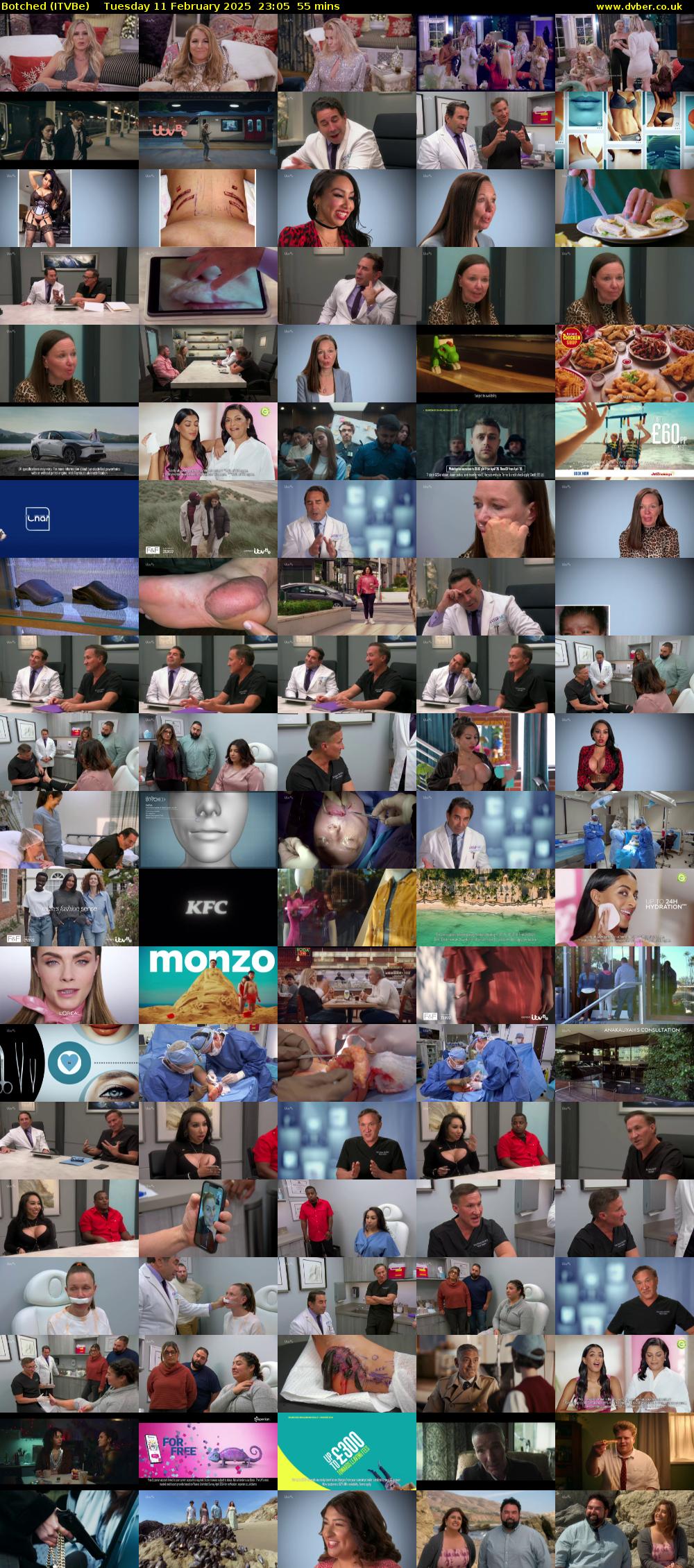 Botched (ITVBe) Tuesday 11 February 2025 23:05 - 00:00