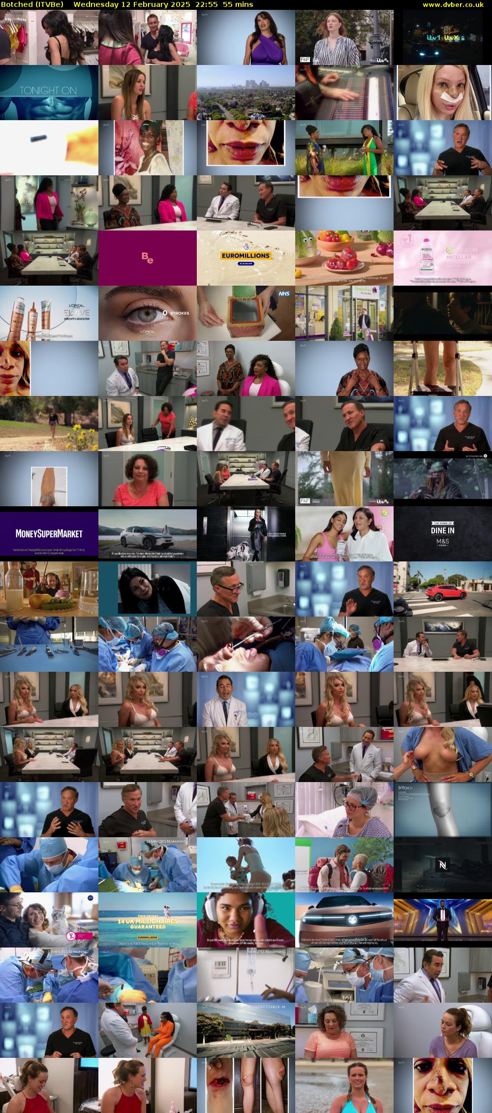 Botched (ITVBe) Wednesday 12 February 2025 22:55 - 23:50