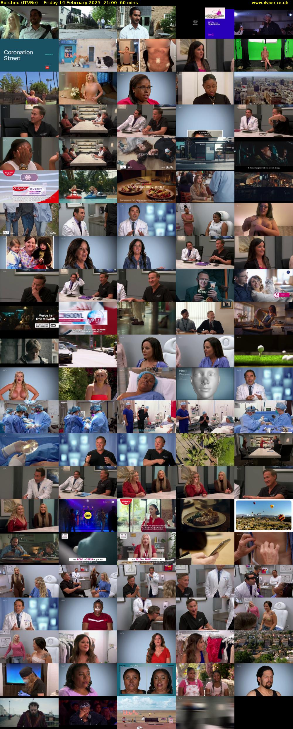 Botched (ITVBe) Friday 14 February 2025 21:00 - 22:00