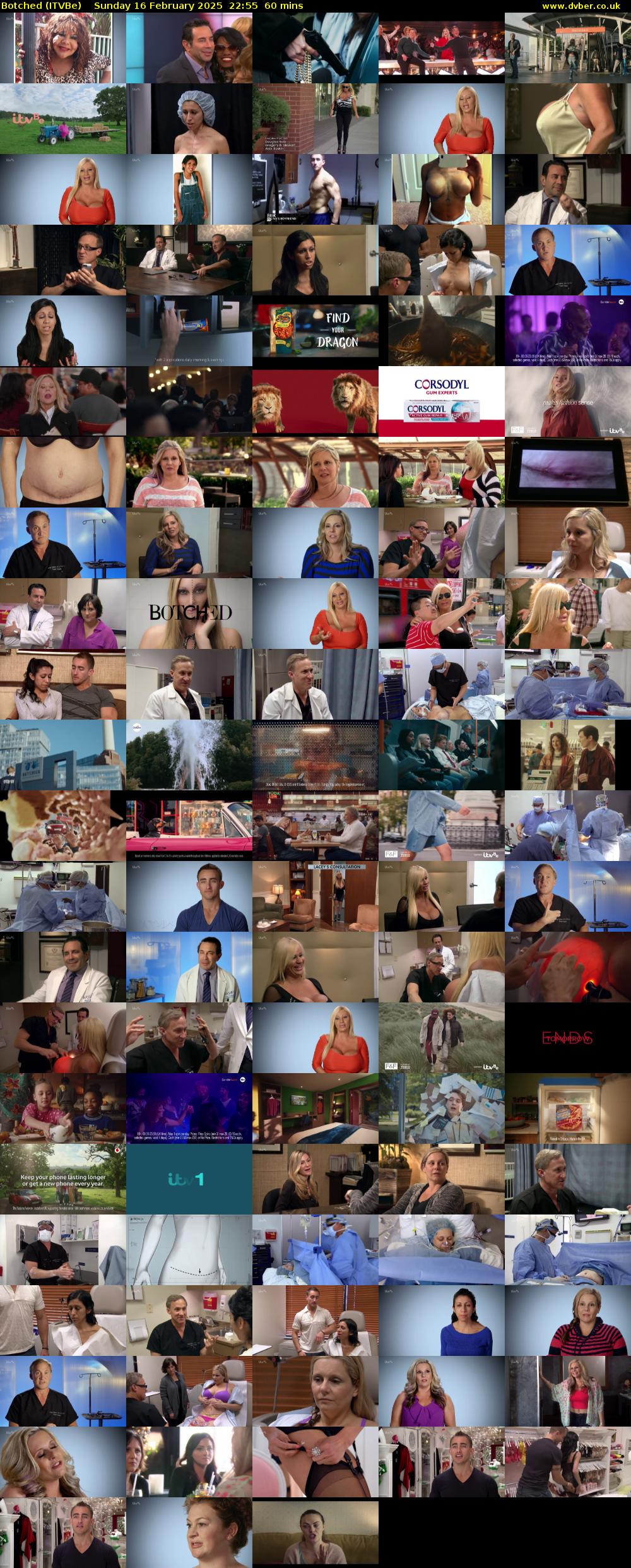 Botched (ITVBe) Sunday 16 February 2025 22:55 - 23:55