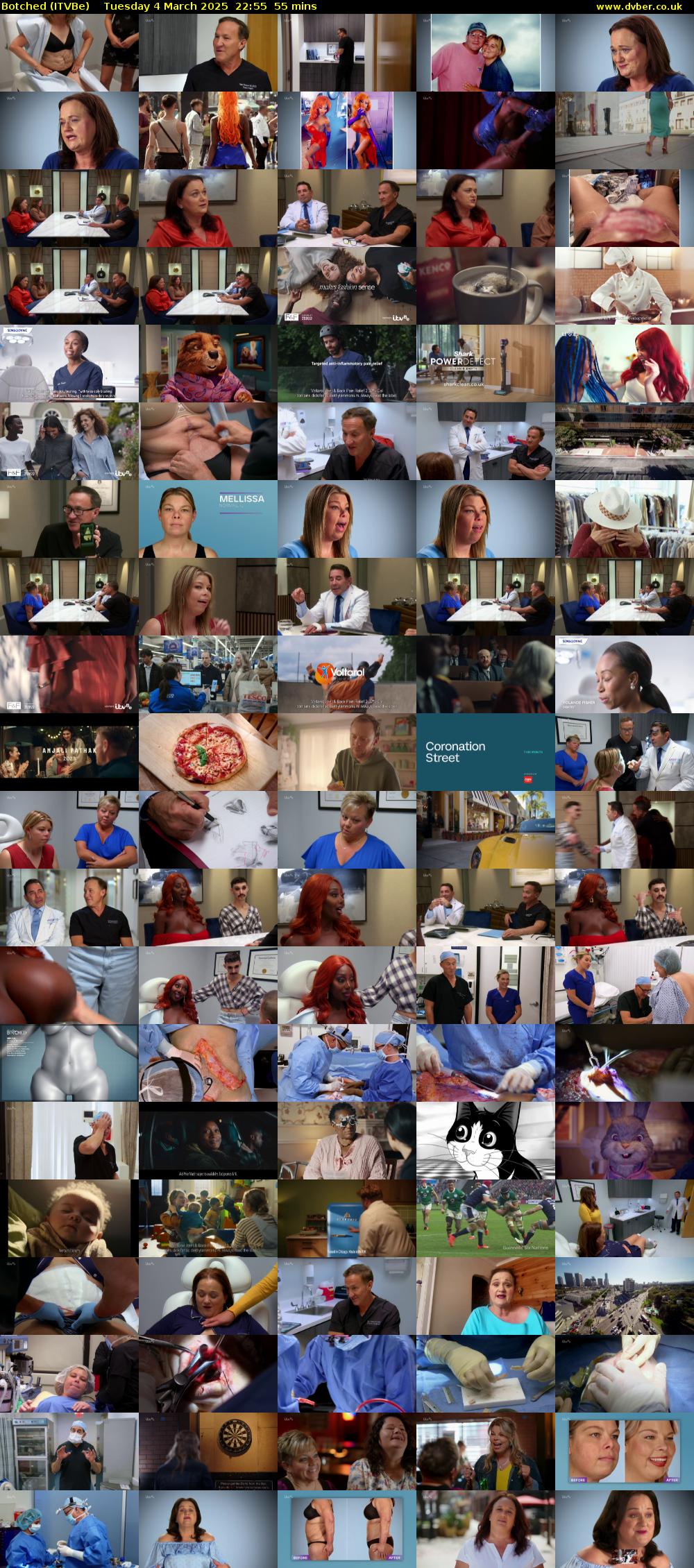 Botched (ITVBe) Tuesday 4 March 2025 22:55 - 23:50