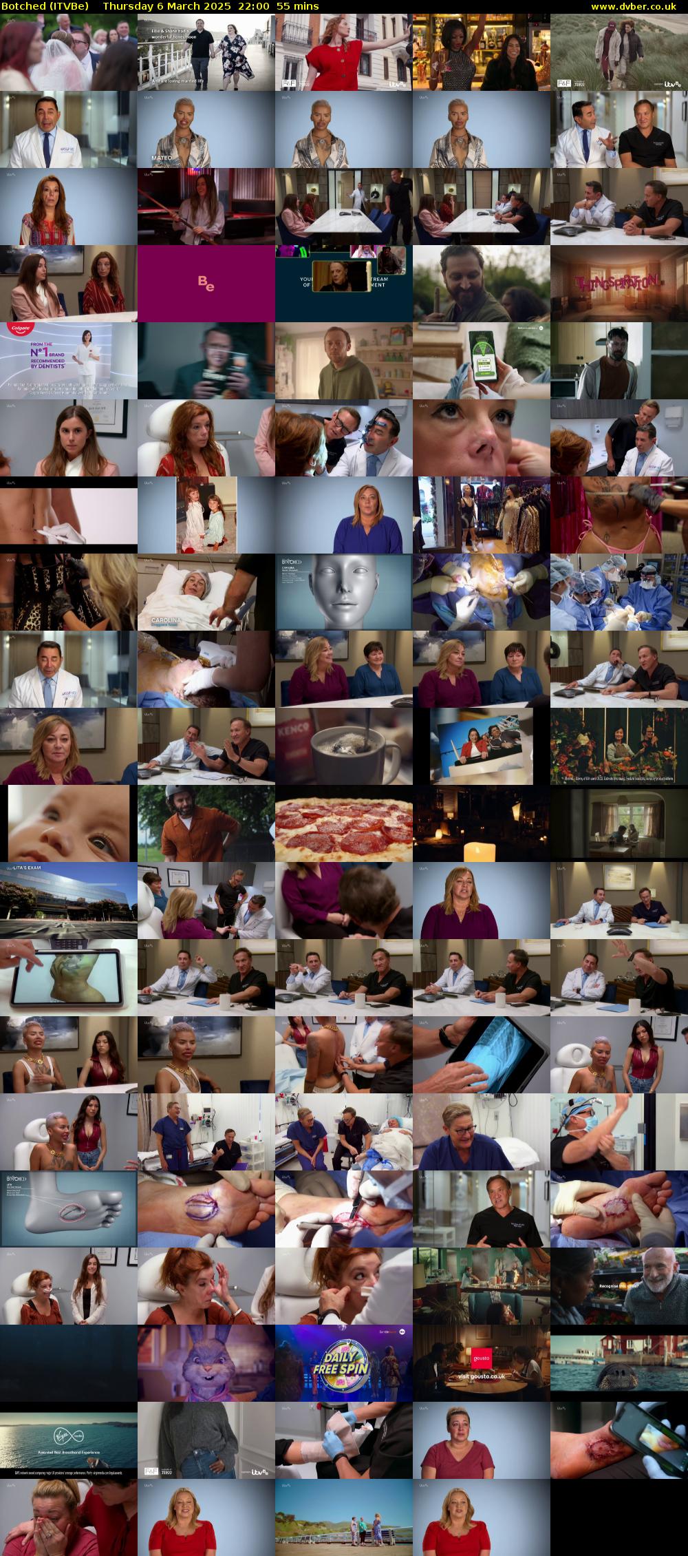 Botched (ITVBe) Thursday 6 March 2025 22:00 - 22:55