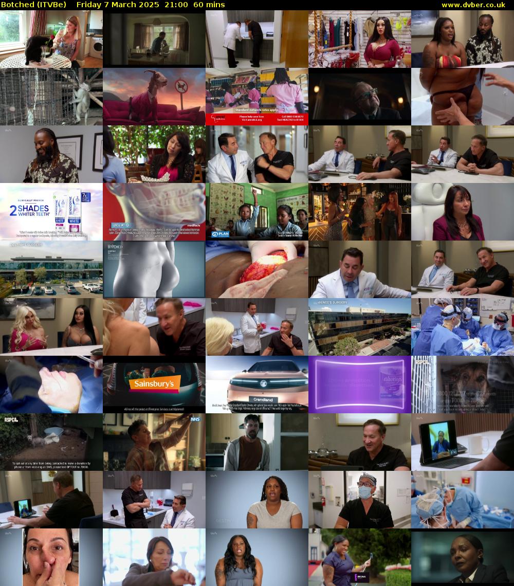 Botched (ITVBe) Friday 7 March 2025 21:00 - 22:00