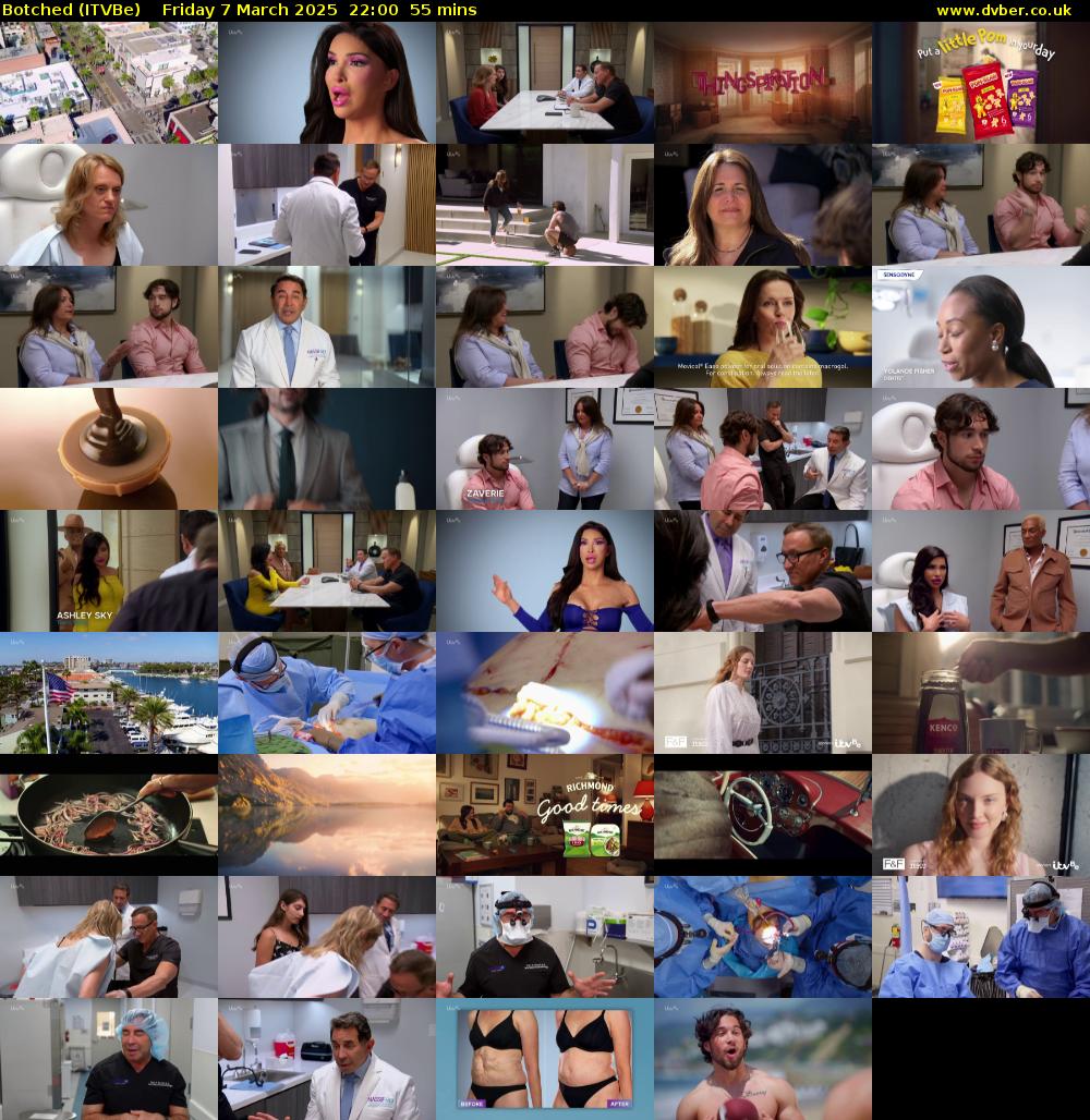 Botched (ITVBe) Friday 7 March 2025 22:00 - 22:55