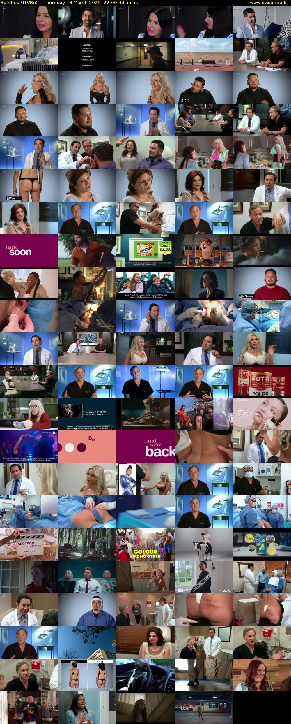 Botched (ITVBe) Thursday 13 March 2025 22:00 - 23:00