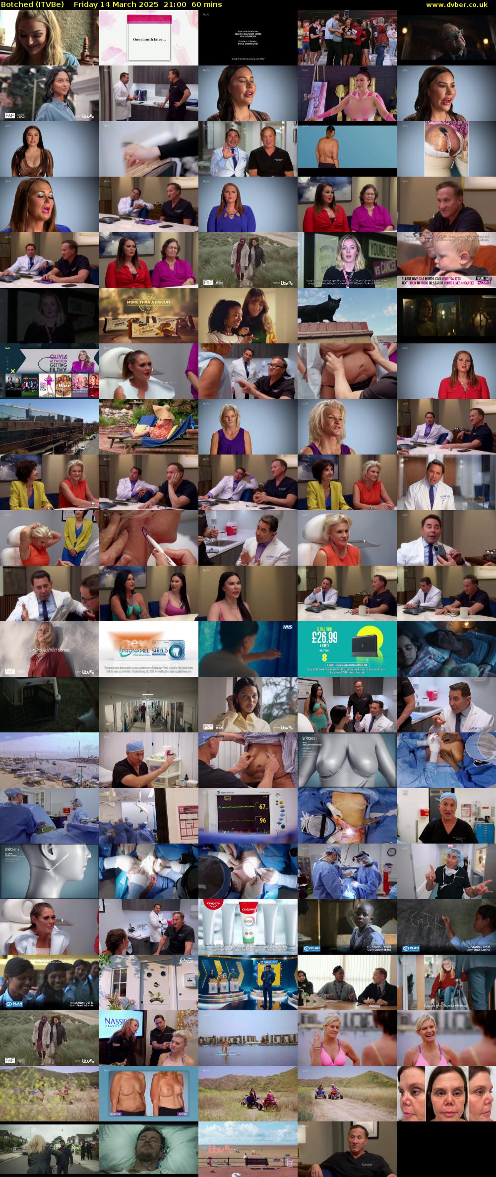 Botched (ITVBe) Friday 14 March 2025 21:00 - 22:00