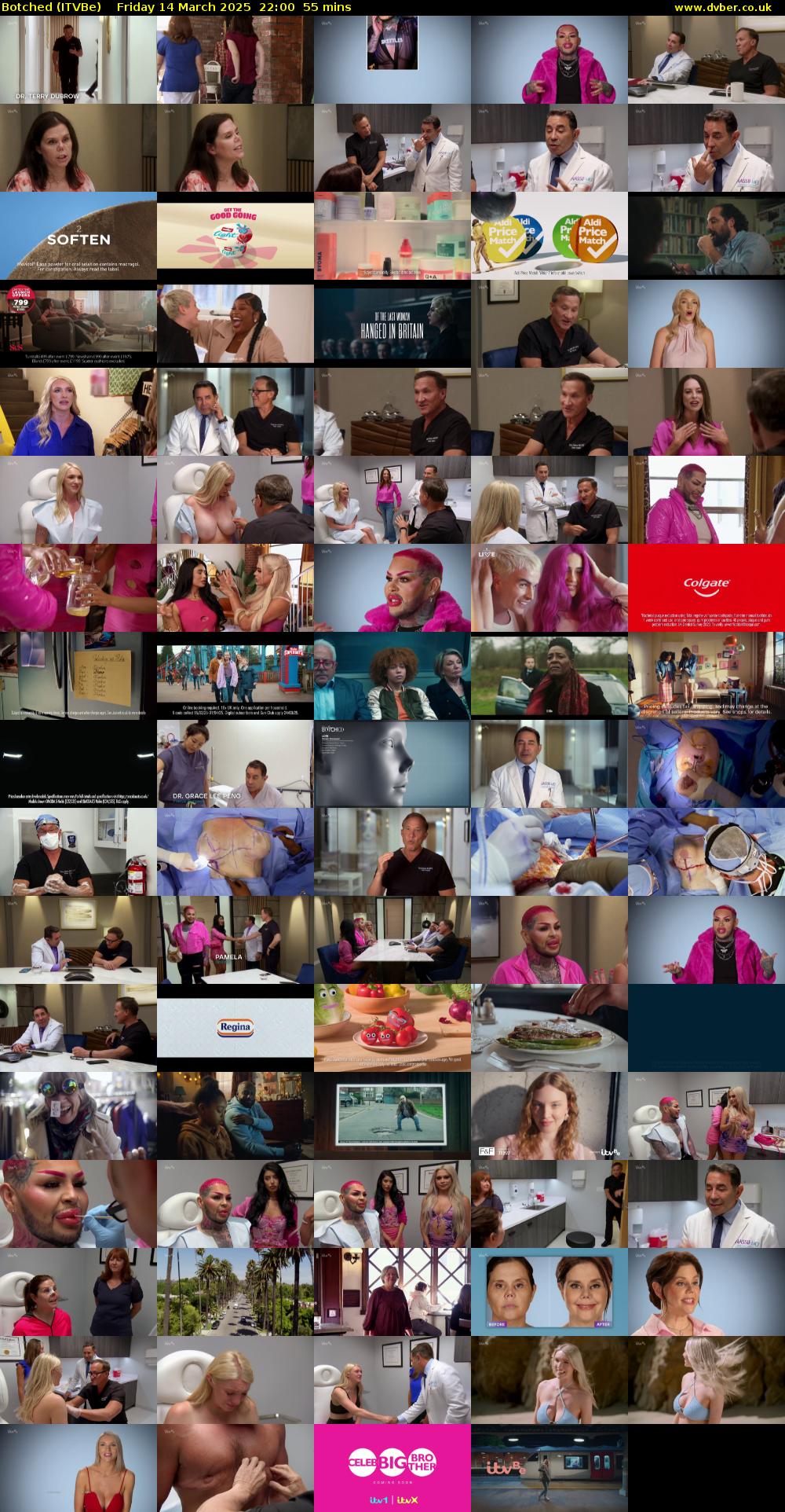 Botched (ITVBe) Friday 14 March 2025 22:00 - 22:55