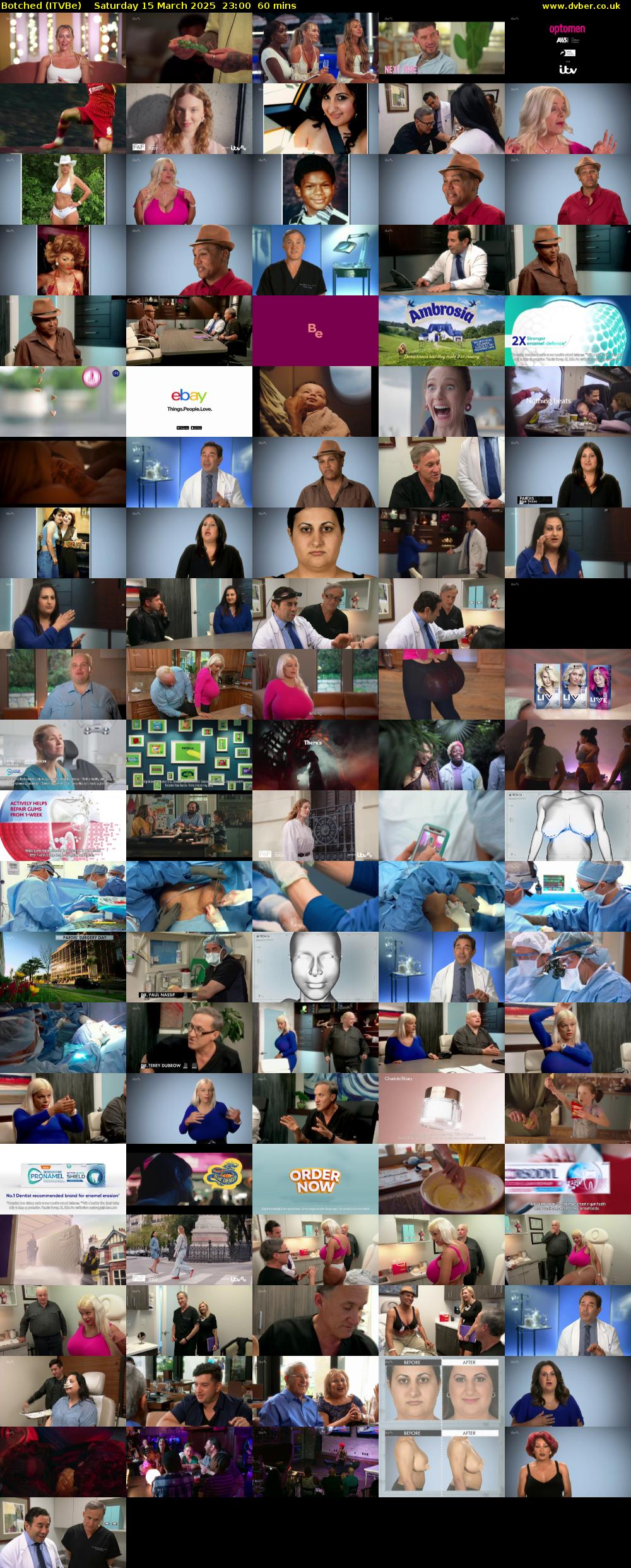 Botched (ITVBe) Saturday 15 March 2025 23:00 - 00:00