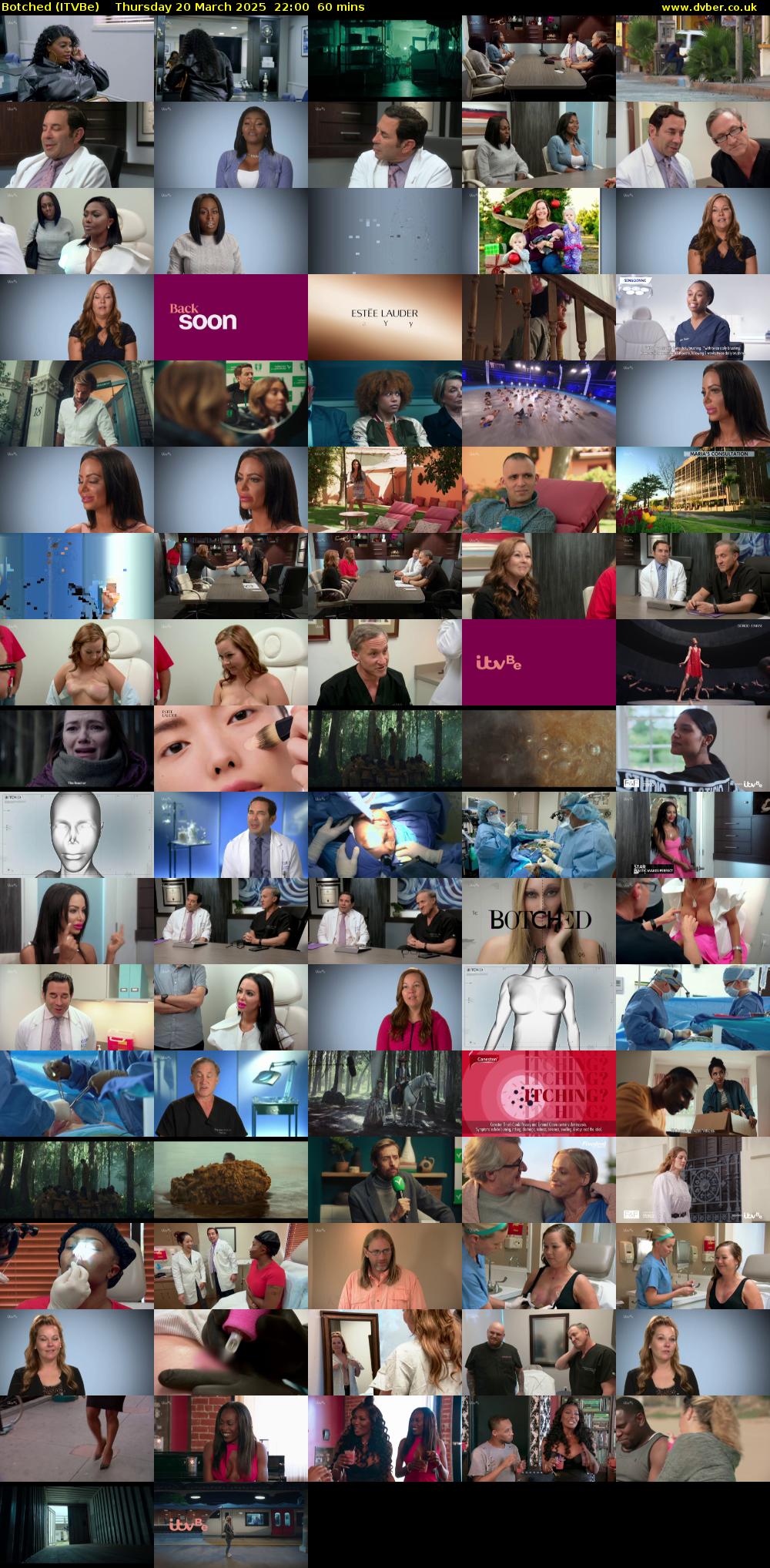 Botched (ITVBe) Thursday 20 March 2025 22:00 - 23:00