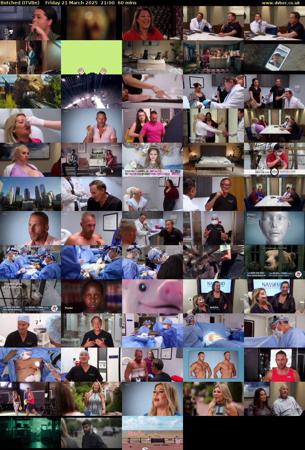 Botched (ITVBe) Friday 21 March 2025 21:00 - 22:00