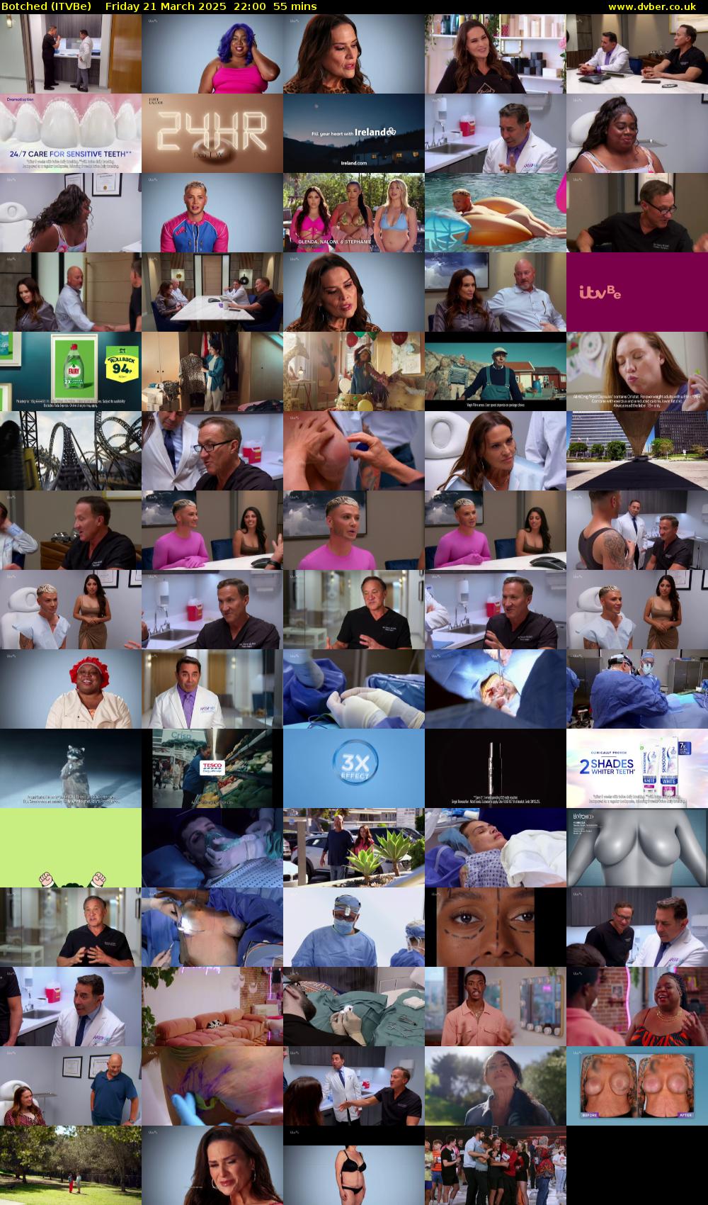 Botched (ITVBe) Friday 21 March 2025 22:00 - 22:55