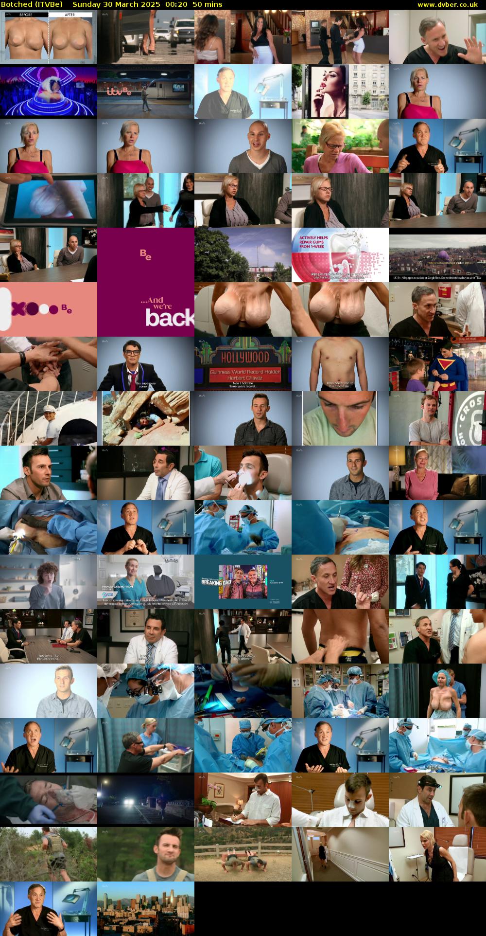 Botched (ITVBe) Sunday 30 March 2025 00:20 - 02:10